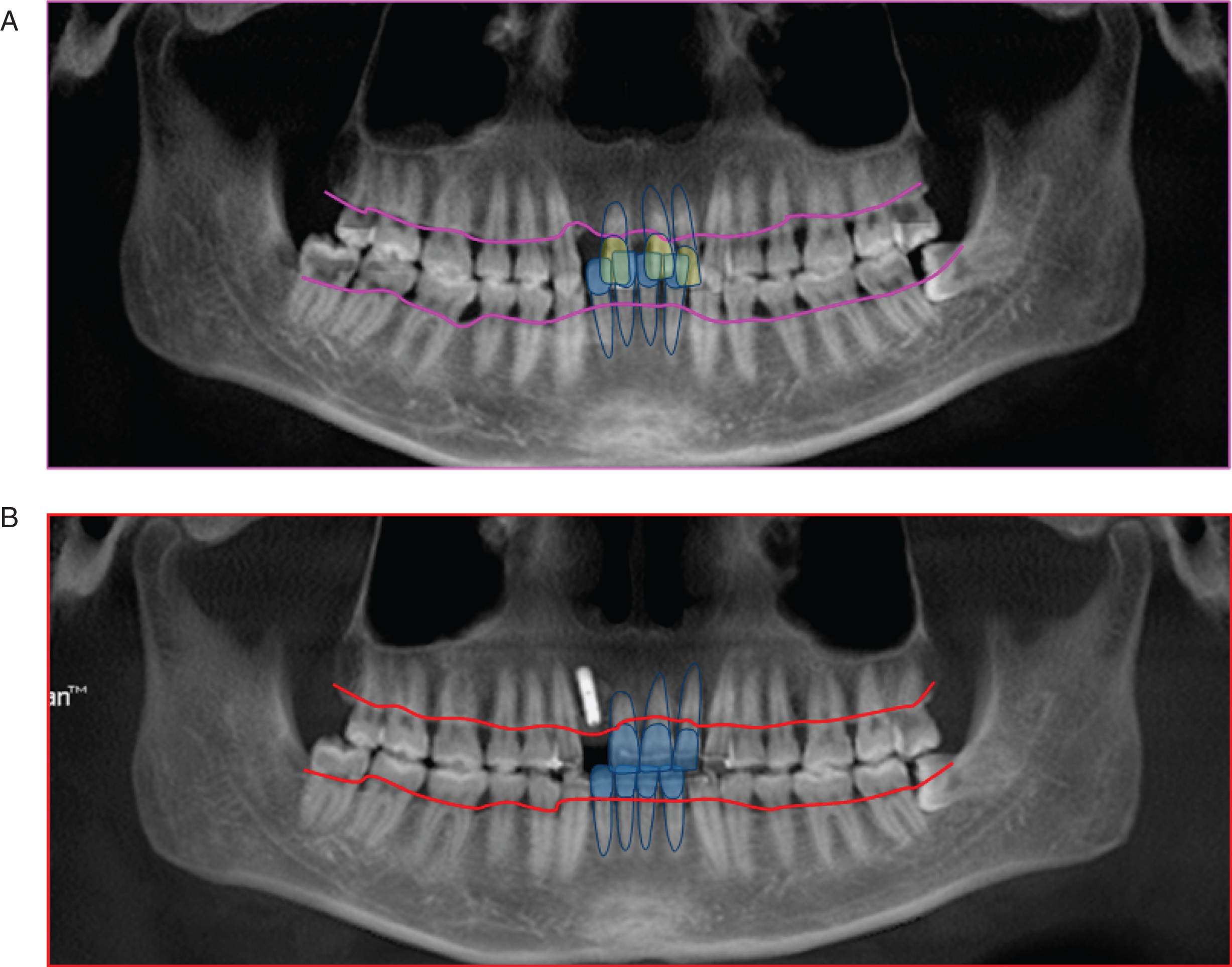 dolphin imaging restore x-ray file