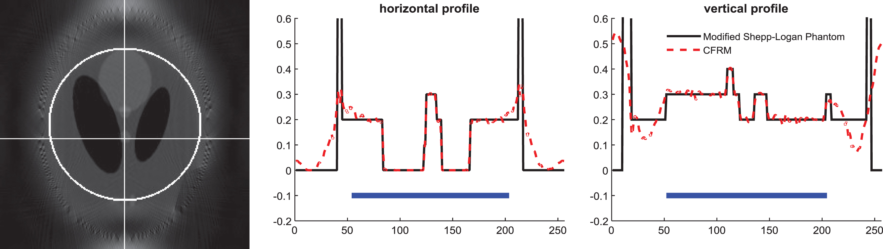 Interior tomography with curvelet-based regularization - IOS Press