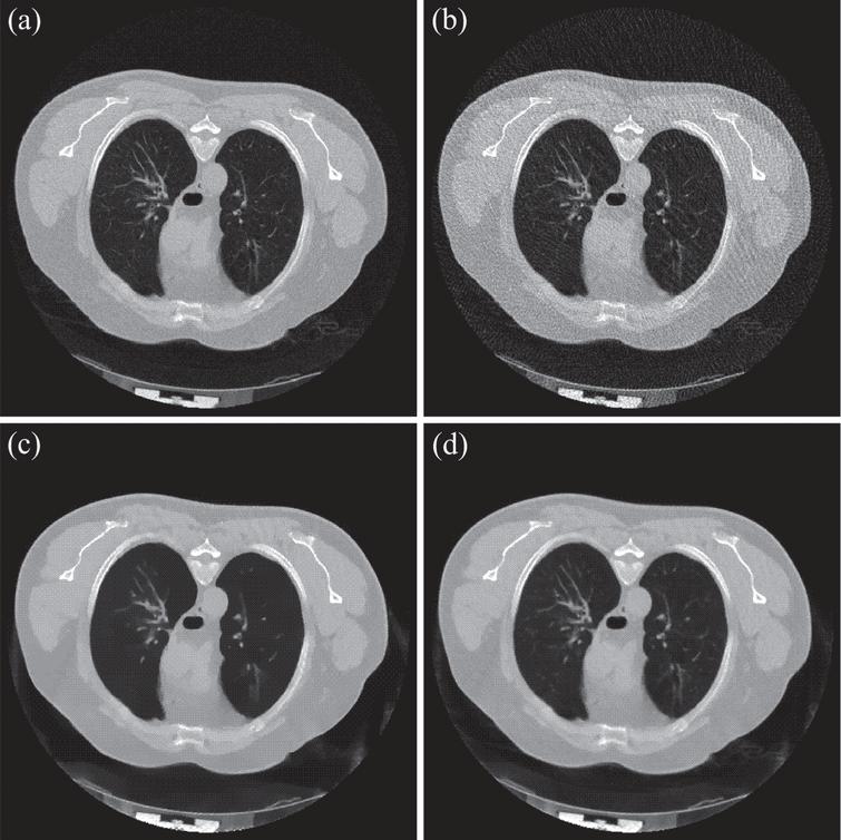 Iterative reconstruction for sparse-view X-ray CT using alpha ...