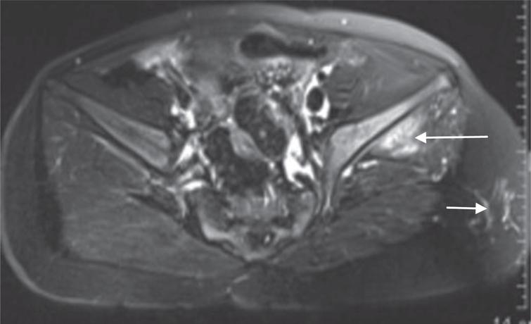 A study of the MR imaging manifestations with injection of sedative at ...