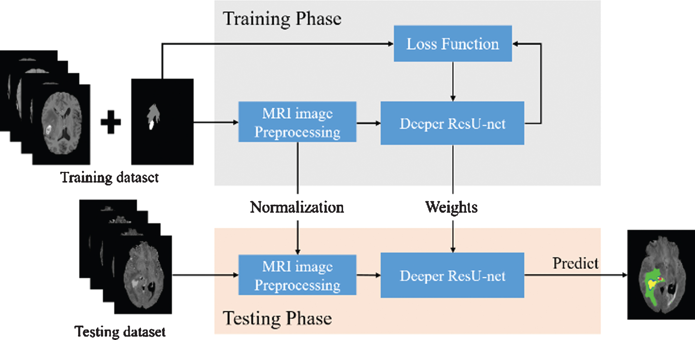 Improving Brain Tumor Segmentation On MRI Based On The Deep U-net And ...