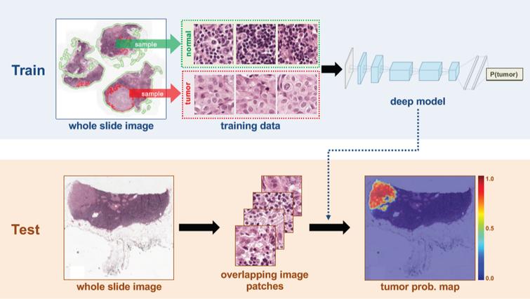 breast cancer detection using deep learning research paper