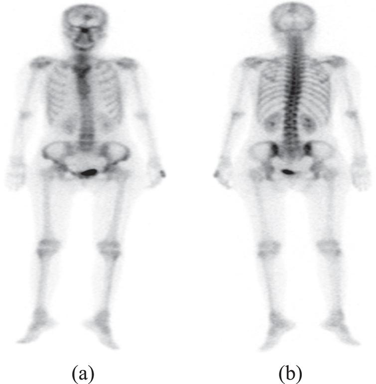 Comparison of irregular flux viewer system with BONENAVI version for ...