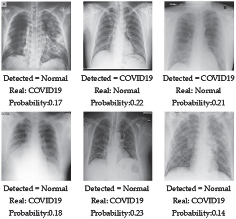 Automatic detection of COVID-19 in chest radiographs using serially ...
