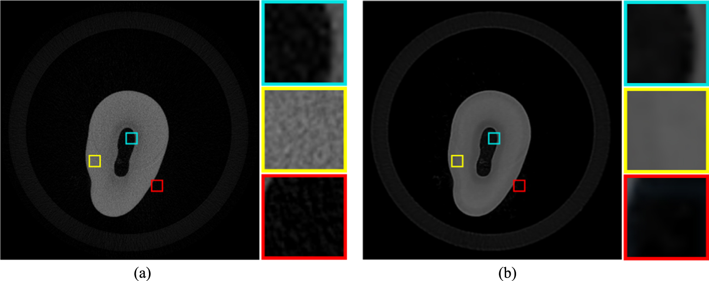 A Blind Medical Image Denoising Method With Noise Generation Network ...