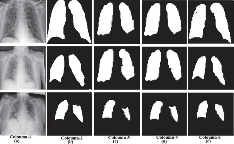 Optimized chest X-ray image semantic segmentation networks for COVID-19 ...