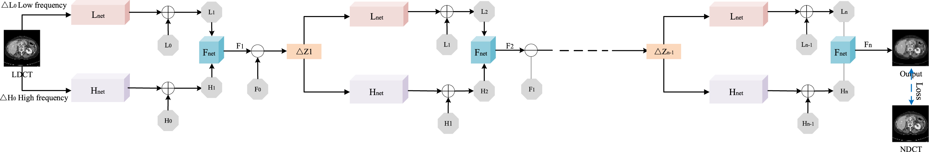 Decomposition iteration strategy for low-dose CT denoising - IOS Press