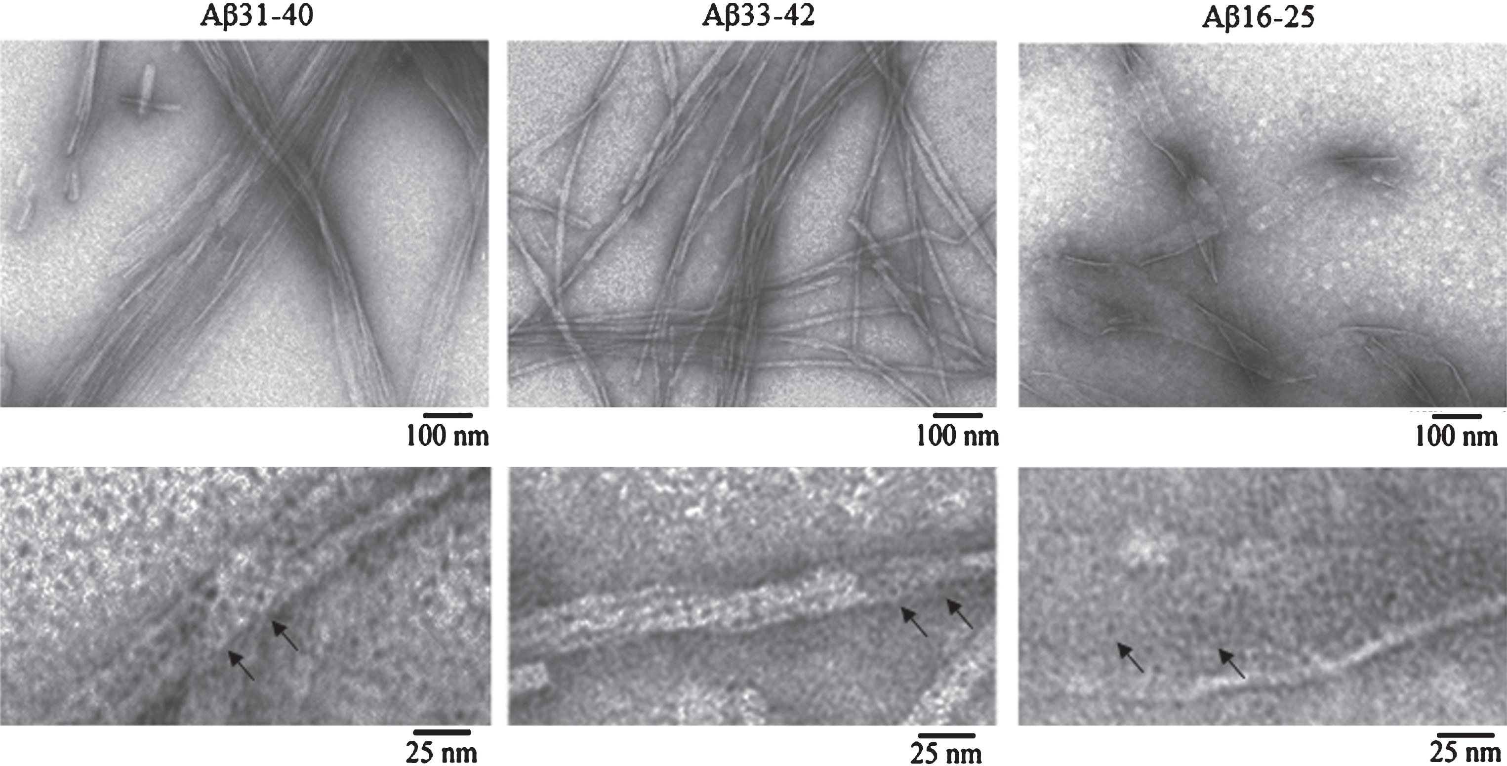 EM images of fibrils formed by Aβ42 peptide fragments. All experiments were performed at concentrations of the preparations 0.25–0.5 mg/ml in 5% DMSO, 50 mM Tris-HCl (pH 7.5) and incubation at 37°C for 24 h. The preparations were negatively stained with 1% aqueous solution of uranyl acetate. Bottom row: fragments of fields at large magnification. Arrows indicate ring-like oligomers with the outer diameter of about 6–7 nm and the inner diameter (hole) of about 2–3 nm.