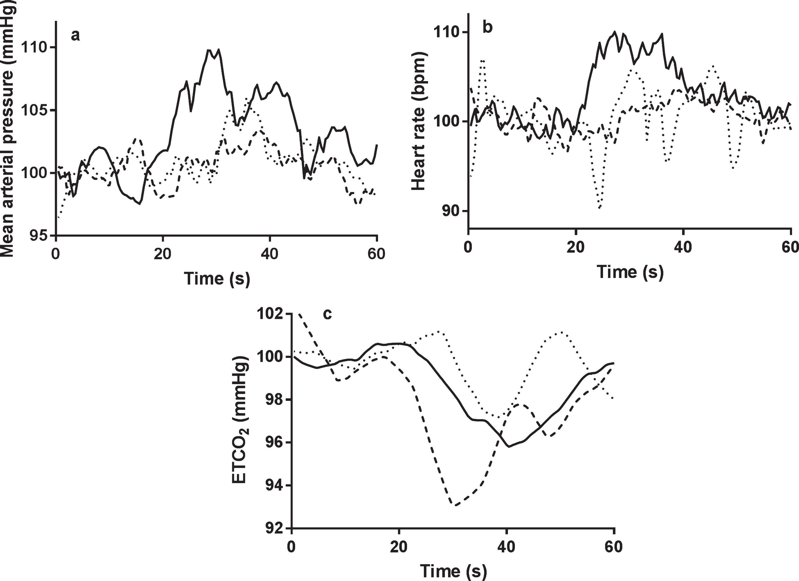 The temporal changes in MAP (a), heart rate (b), and ETCO2 (c), to the language task. All signals were normalized by baseline values. Continuous line = healthy control, dotted line = mild cognitive impairment, interrupted line = Alzheimer’s disease. a) non-dominant hemisphere; b) dominant hemisphere. Task initiation occurred at 20 s.
