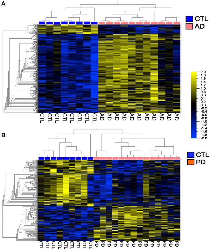 Heatmaps of genes hierarchically clustered from the AD population (A) (q < 5%, Fold Change > 1.3); and the PD population (B) (q < 5%, Fold Change > 1.5). Note that these analyses separated the AD and PD populations from their respective CTL samples. Both heatmaps were created in Qlucore using FPKM normalization.
