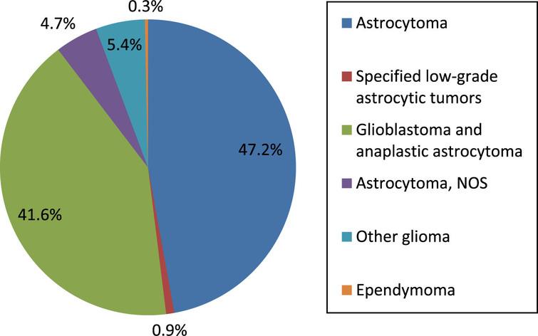 Malignant brain tumor types in persons 65 and older, data from SEER (74,389 cases). Astrocytoma, astrocytoma NOS (not otherwise specified), specified low grade astrocytic tumors and other glioma comprise the lower grade gliomas.
