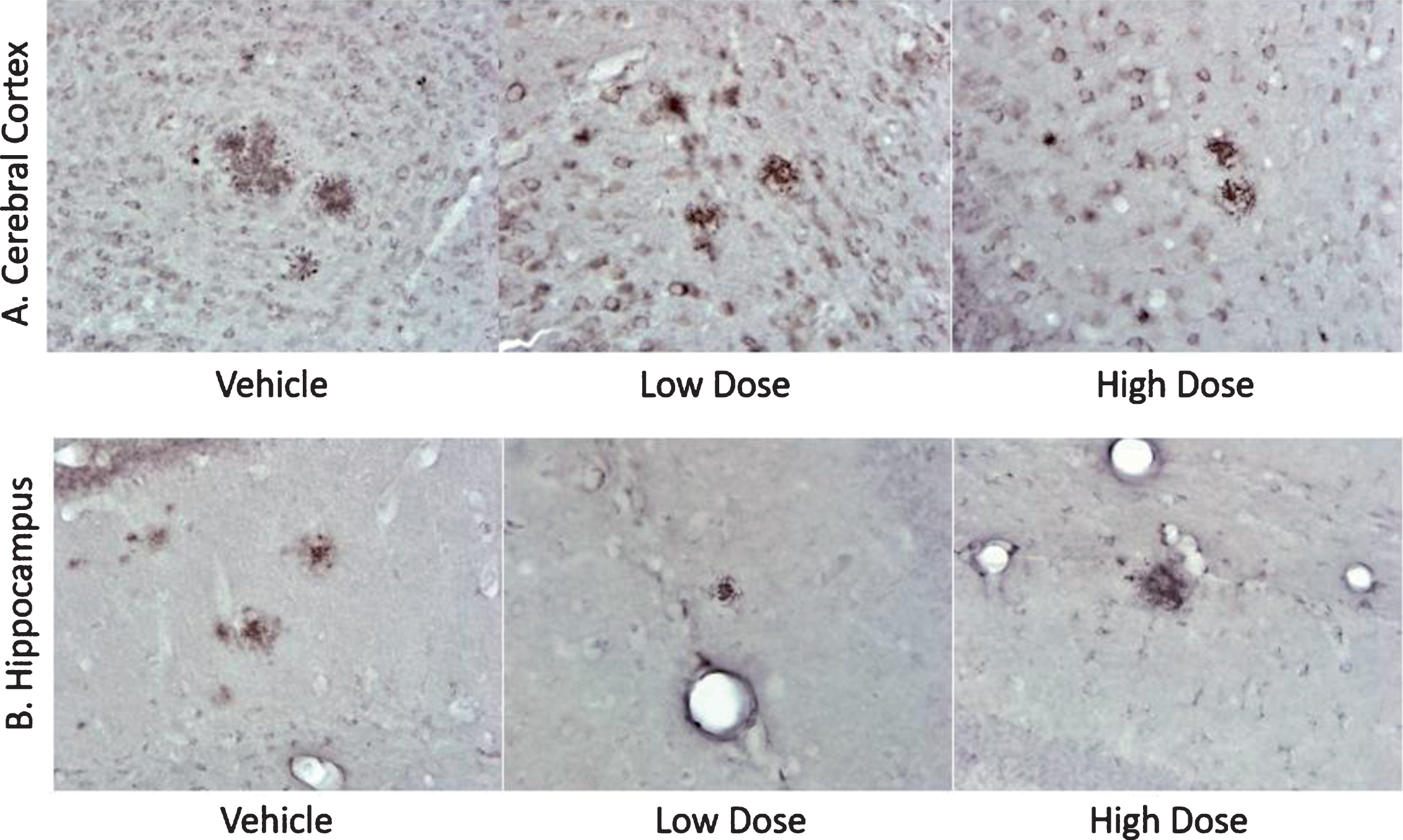 Histology sections of AD mice from efficacy study. Immunohistology sections of cerebral cortices (A) and hippocampi (B) from experimental mice as indicated representing amyloid plaques (dark red spots, at 40x magnification). The cumulative data representing total number of plaques and the surface area are presented in Table 2.