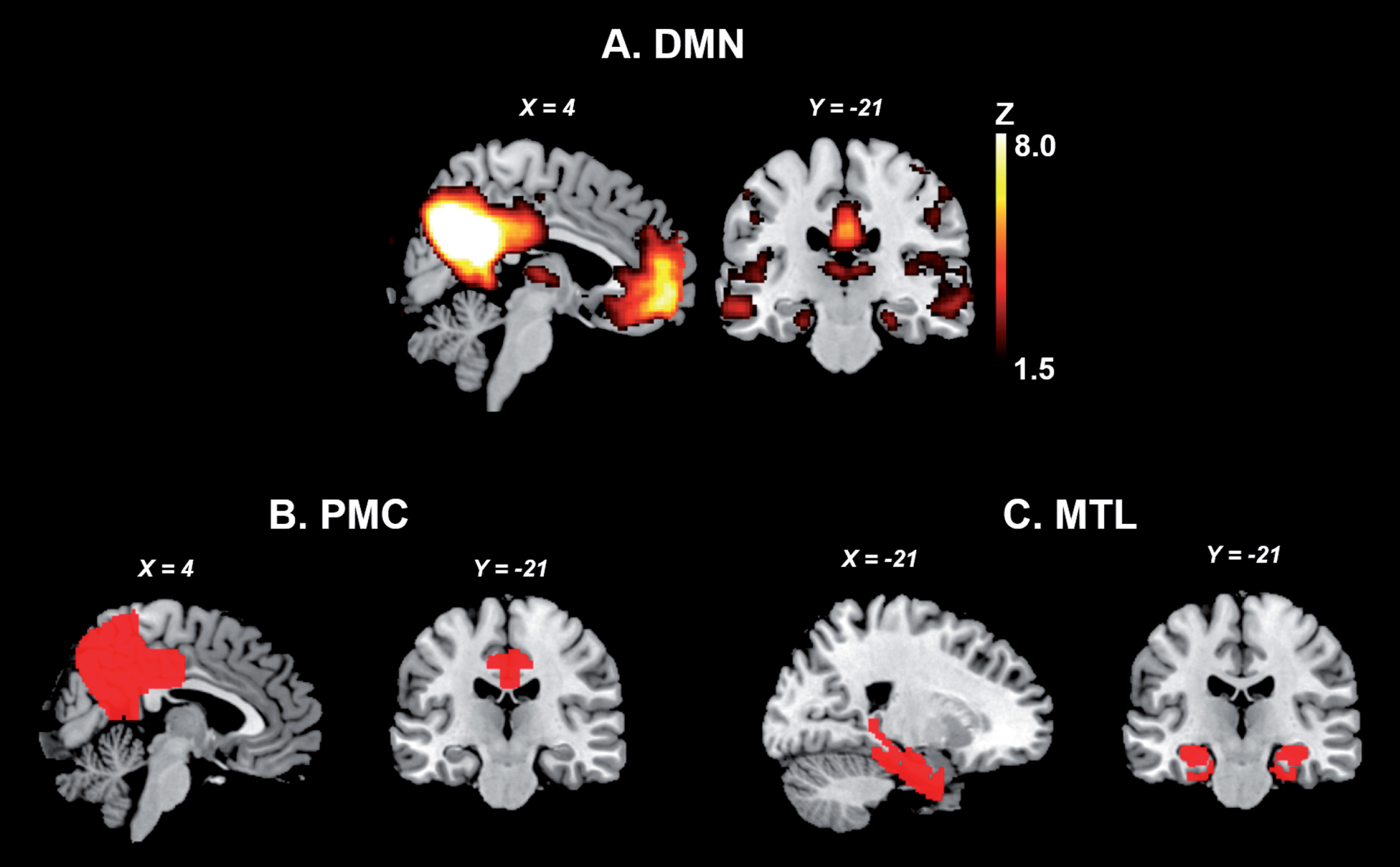 The MTL and PMC of the DMN. A. Publicly available spatial map of the DMN derived from an independent component analysis on resting-state fMRI data of 36 healthy subjects (https://www.fmrib.ox.ac.uk/datasets/brainmap+rsns/). B and C show the location of the PMC and MTL, respectively (Harvard-Oxford Cortical and Subcortical Atlas). DMN, default mode network; MTL, medial temporal lobes; PMC, parietomedial cortex.