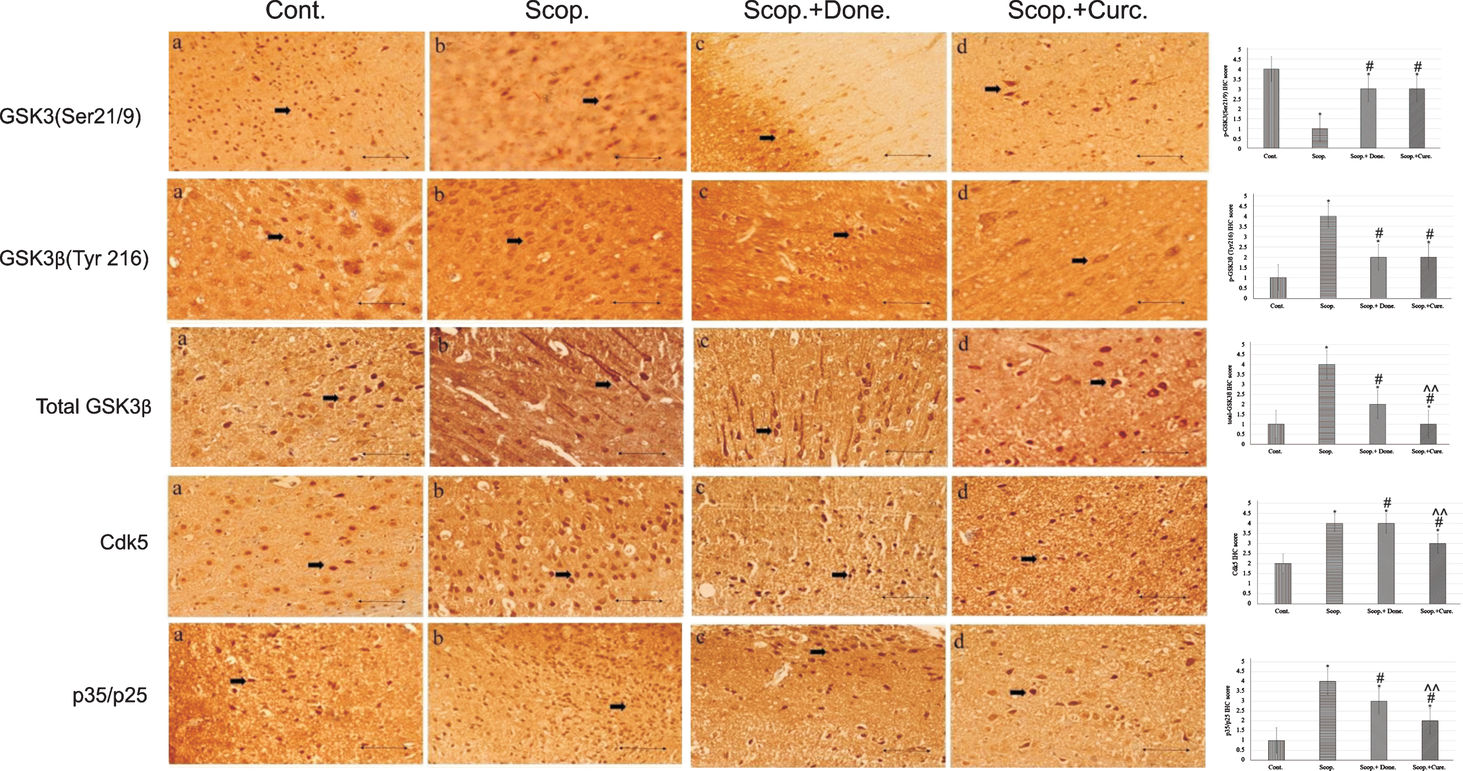 Immunohistochemistry images of (i) GSK3α/β(Ser 9/Ser21), (ii) GSK3β(Tyr 216), (iii) total GSK3β, (iv) Cdk5, and (v) p35/p25 in the brain sections (cortex) of rat that were treated with Cont., Scop., Scop.+Done., and Scop.+Curc. The assay (n = 4) was done in triplicate. Lens objective: 40x. Scale bar represents 1 μ. (*p < 0.001, **p < 0.01, and ***p < 0.05 versus saline-treated group; #p < 0.001, ##p < 0.01, and # # #p < 0.05 versus scopolamine-induced AD rats, ∧p < 0.001, ∧∧p < 0.01, and ∧∧∧p < 0.05 versus scopolamine-donepezil rats. n = 4). Cont., control; Scop., scopolamine; Done., donepezil; Curc., curcumin.