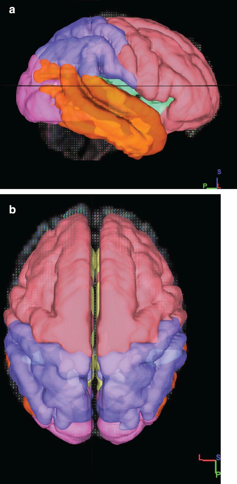 Overview of the division of the SWM of the brain into the frontal (pink), insula (green), limbic (yellow), parietal (blue), temporal (orange), occipital (Purple) lobes. a) 3D sagittal view b) 3D Axial View.