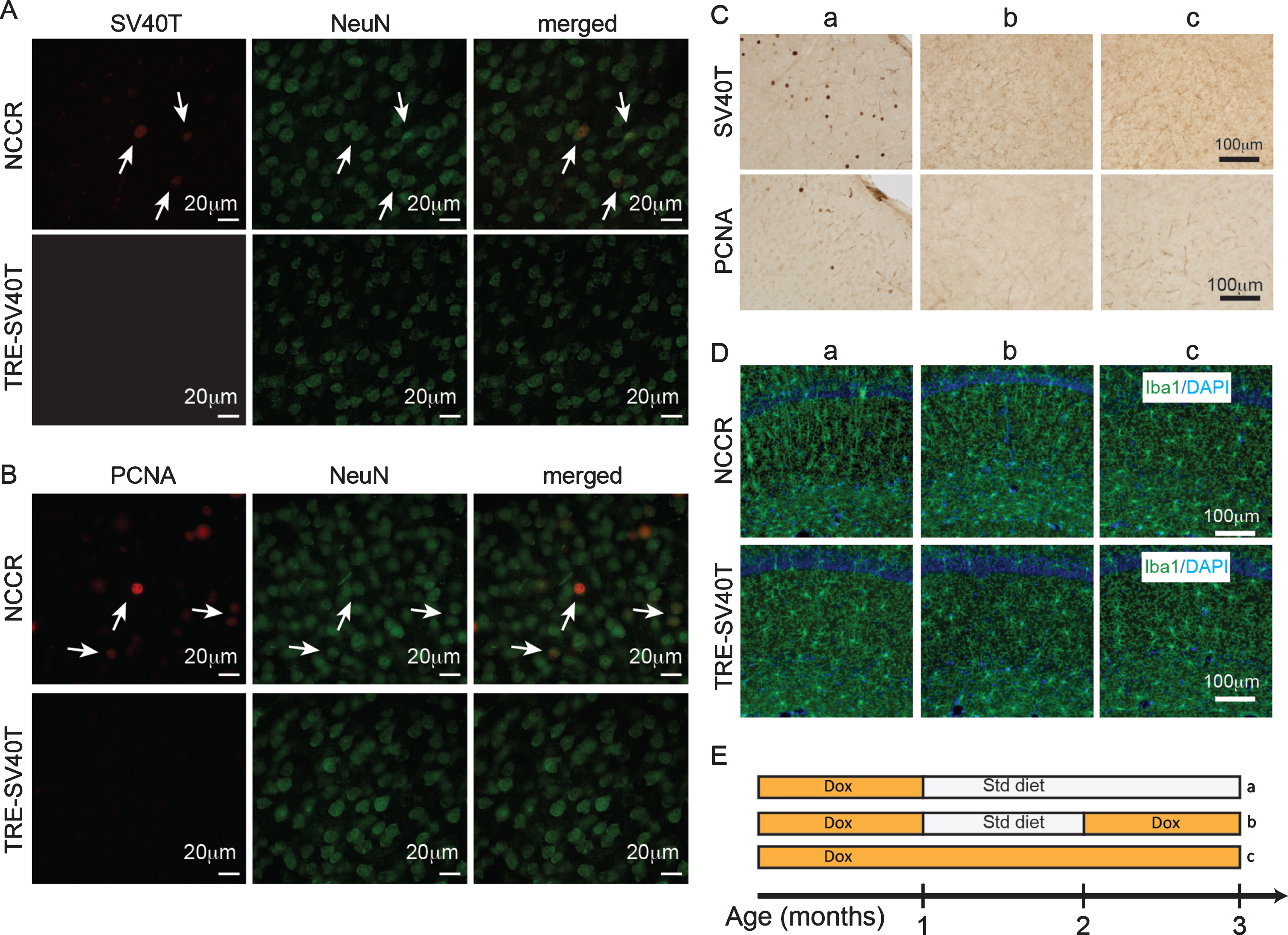 Forced neuronal cell cycle re-entry induces microglia activation. A) Immunofluorescence labeling shows SV40T and NeuN co-label (arrows) in 4-month-old NCCR mice (n = 4). TAg control animals (n = 4) do not show SV40T immunofluorescence. B) Immunofluorescence labeling shows PCNA and NeuN co-label (arrows) in 4-month-old NCCR mice (n = 4). TAg control animals (n = 4) do not show PCNA immunofluorescence. C, a) NCCR animals (n = 3) maintained on standard (Std) diet starting at 1 month of age and examined at 3 months of age show persistent expression of SV40T and PCNA (marker of cell cycle activation) in the cortex (shown) and hippocampus (data not shown). C, b) The SV40T expression is tightly regulated by dox diet in the NCCR mice. SV40T and PCNA stains are absent in a separate group of NCCR mice (n = 3) that are put back on dox diet at 2 months of age and examined at 3 months of age. C, c) The NCCR animals that are continuously maintained on dox diet (n = 3) do not show any SV40T or PCNA stains. D, a) The same animals in Ca show Iba-1 labeled rod-like activated microglia in the hippocampus. TAg control animals maintained in the same diet regimen do not show rod-like microglia. D, b) The rod-like microglia in the NCCR animals become morphologically less pronounced in the hippocampus when they are put back on dox diet for 1 month. D, c) When the NCCR animals are always maintained on dox diet (SV40T is chronically turned off), the microglia display morphological features and distribution patterns typical of resting microglia that are similar to TAg control animals (TRE-SV40T) under different diet treatment conditions. E) Schematic showing the different diet treatments used in the experiment. Lower case letters next to the treatment conditions correspond to the lower case letters shown in the image panels in C and D. Scale bar = 100 μm.