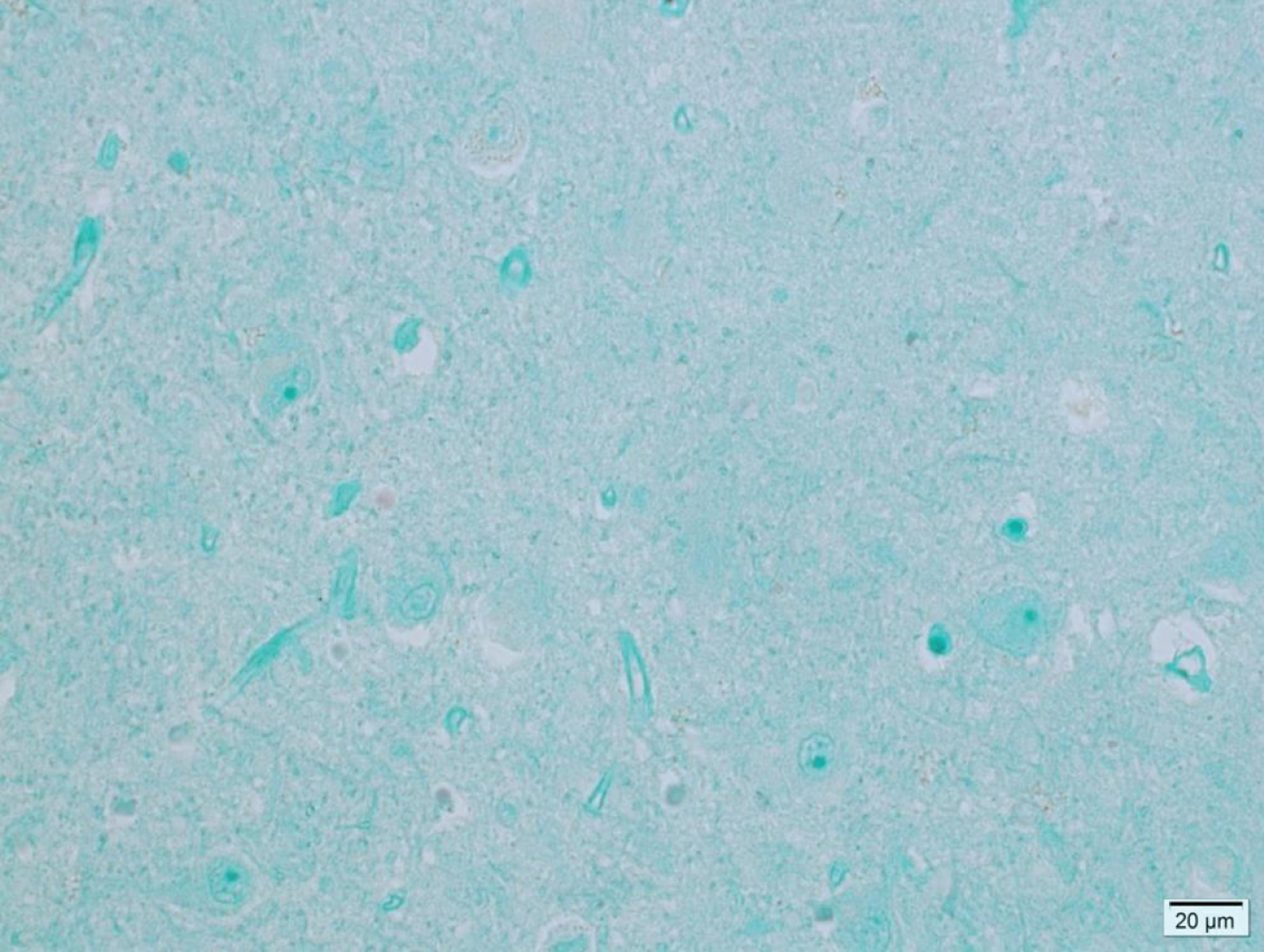 Microphotograph of formalin-fixed hippocampus tissue from a 78-year-old control patient showing no viral antigen staining.