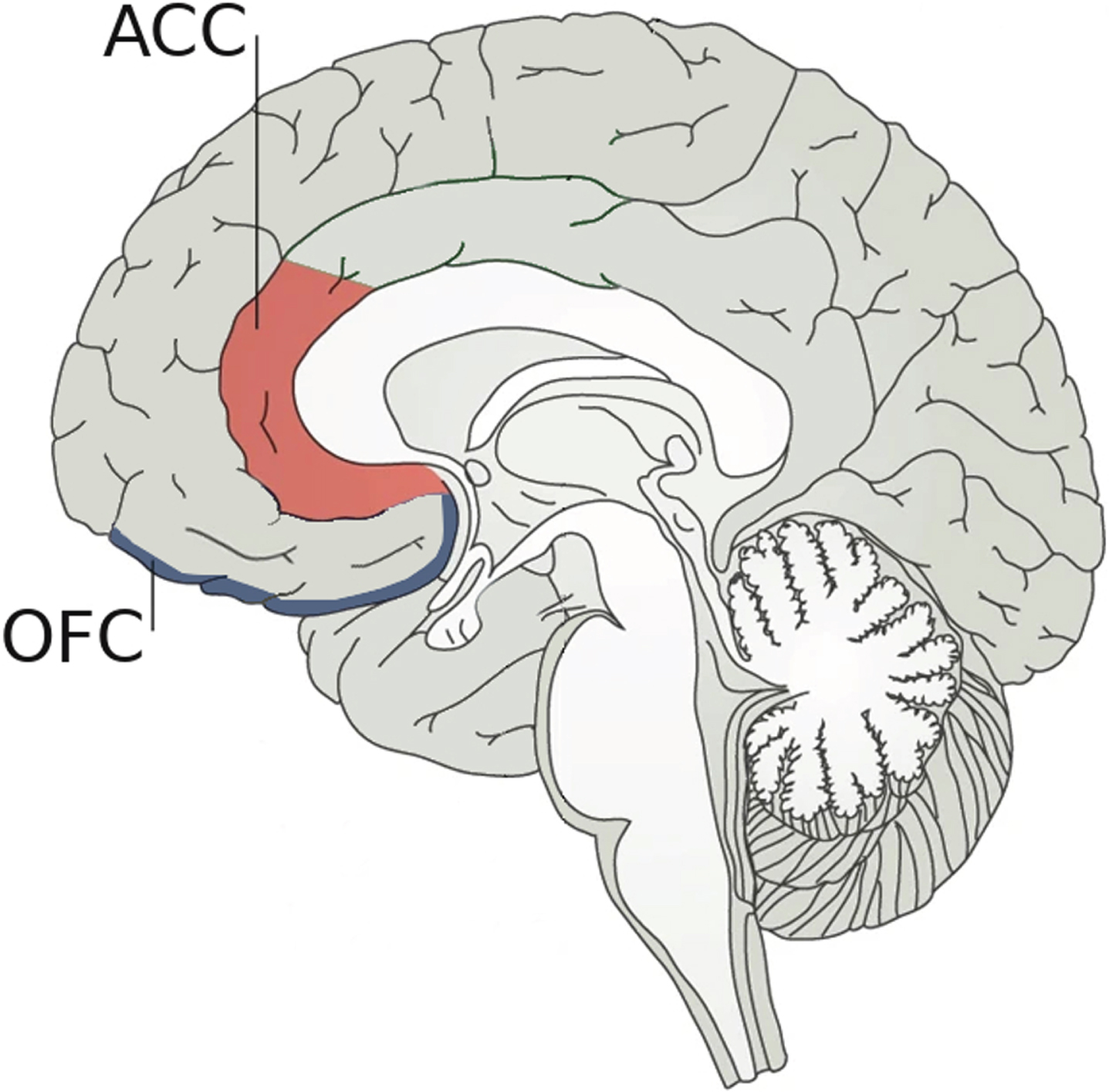 Neuroanatomical bases underlying social decision-making. Social decision-making, which is crucial to establishing and maintaining successful social relationships, is supported by two pivotal brain regions: 1) the anterior cingulate cortex (ACC) that plays an important role in the ability to recognize emotions by evaluating predictions about the emotional states of others; and 2) the orbital frontal cortex (OFC) that judges the possible choices of behavior. Damage in any of these two areas could affect social cognition.