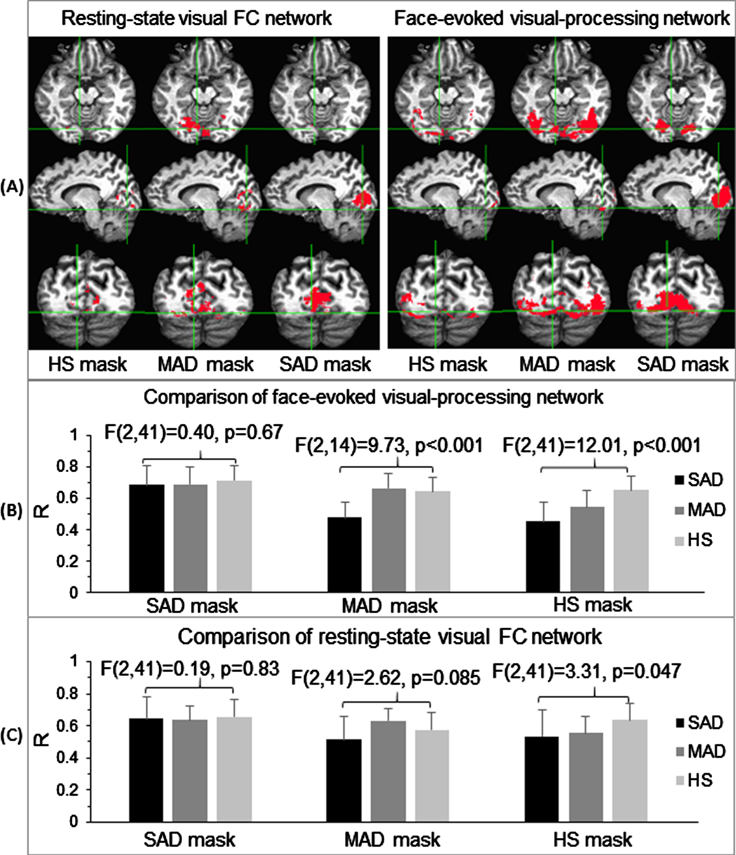 Illustration of the three group-specific network masks for the two functional states (A), and their corresponding group comparisons for the three subject groups: the face-evoked visual-processing network (B) and the resting-state visual FC network (C). For each functional network, the SAD mask is the cortical area of the corresponding functional network of the SAD patients alone. The MAD mask is the cortical area of the corresponding functional network of the MAD patients, excluding the corresponding SAD mask, i.e., the part of the MAD network distinct from the SAD network. The HS mask is the cortical area of the corresponding functional network of the HS controls, excluding both MAD and SAD masks. The error bar indicates the standard deviation.