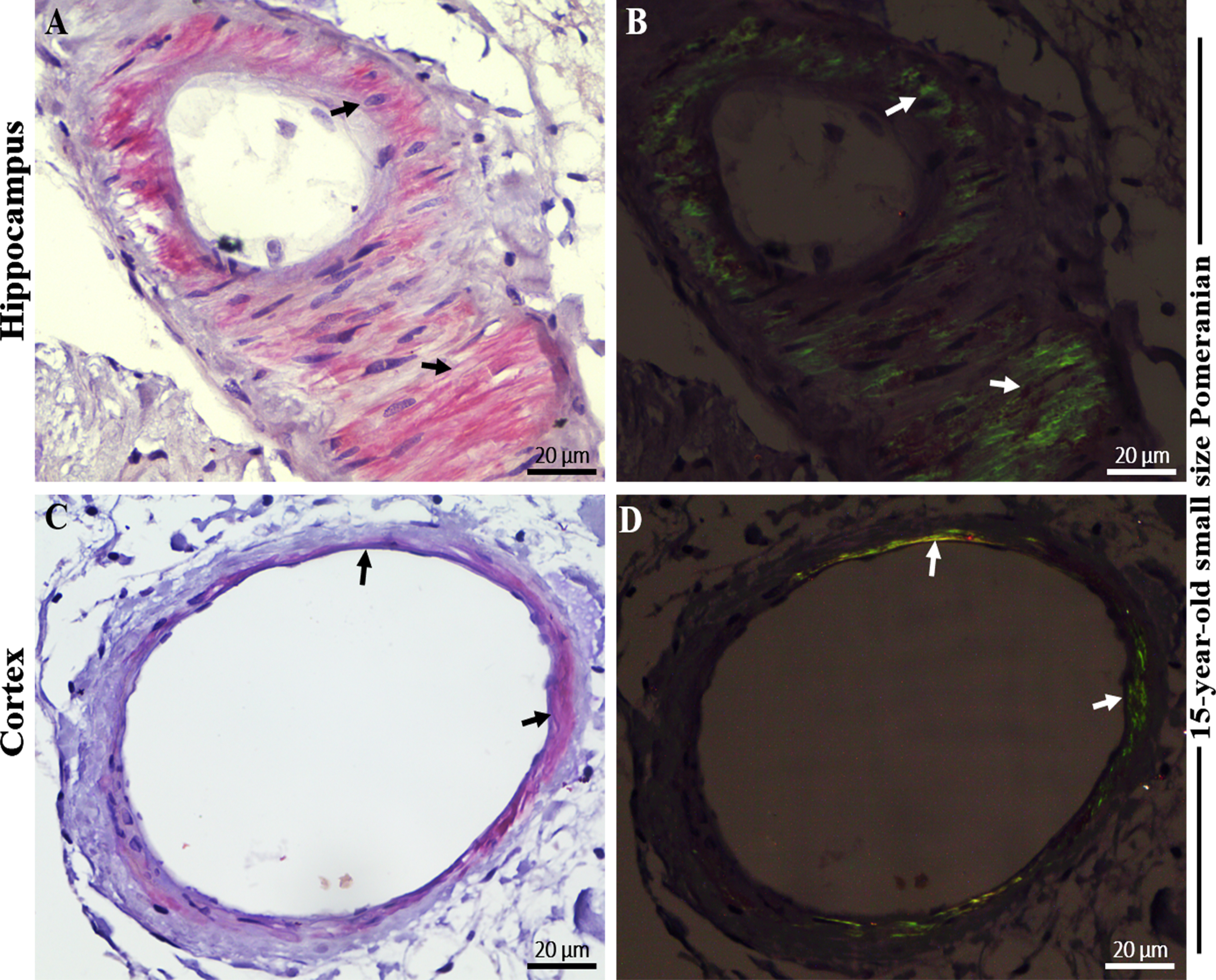 Photomicrographs of Congo red (CR) staining in cerebral amyloid angiopathy (CAA) in the brain hippocampal and cortical region of an aged dog. Distinctive red brick staining of cerebral blood vessels (largely the tunica media) (A) in the hippocampus and (C) in the frontal cortex (black arrows) of a 15-year-old small size Pomeranian following CR-hematoxylin staining. Vascular amyloid, confirming CAA, with the presence of apple-green birefringence (B) in the hippocampus and (D) in the frontal cortex (white arrows) of a 15-year-old small size Pomeranian under polarized light. Representative of all aged dogs. Scale bar = 20μm.