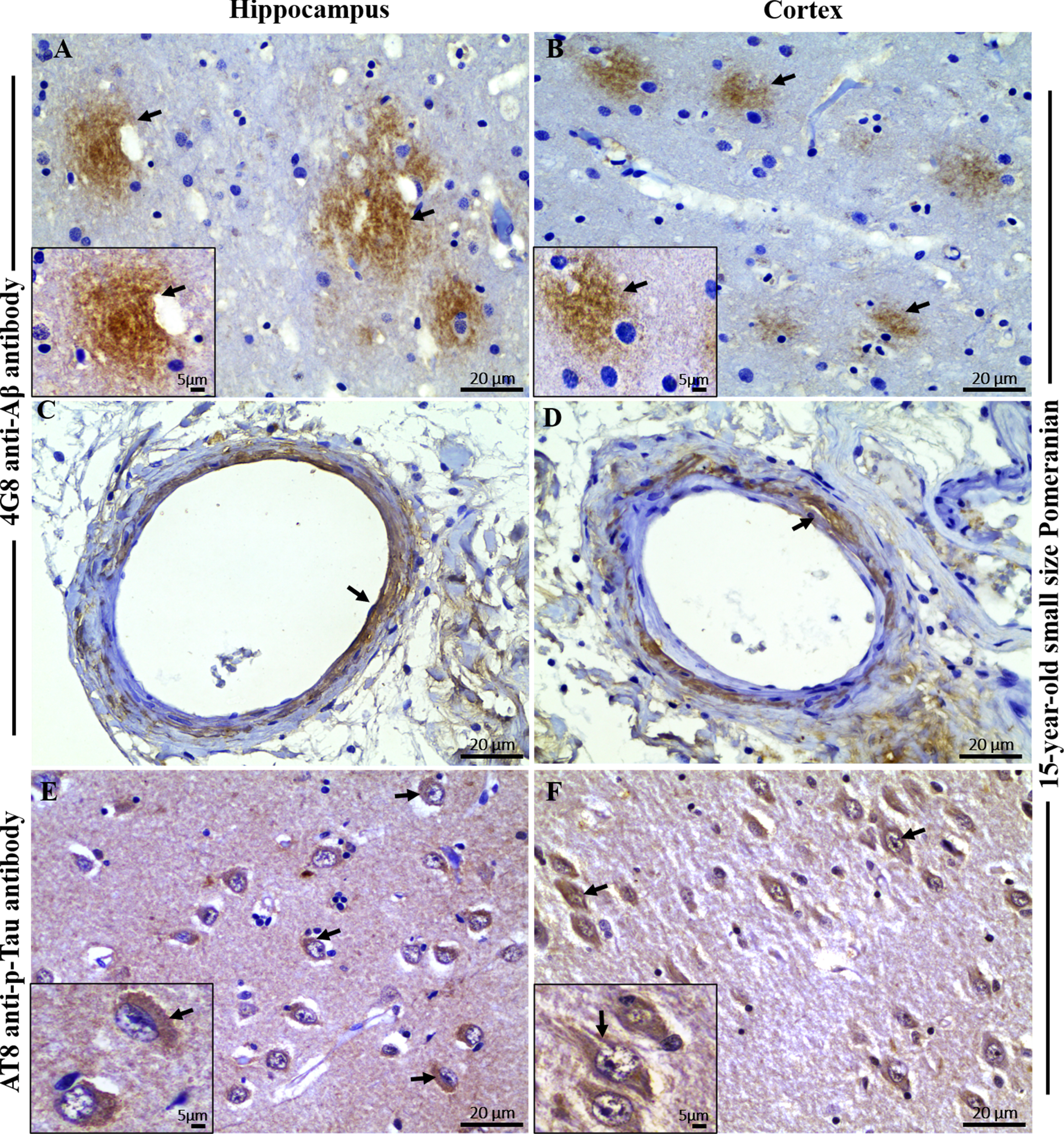 Immunohistochemical staining with 4G8 anti-Aβ and AT8 anti-pTau antibody in the brain hippocampal and cortical region of an aged dog. Immunohistochemical staining showed extensive extracellular Aβ plaques in the A) hippocampus and B) frontal cortex (black arrows) of a 15-year-old small size Pomeranian. Staining of vascular amyloid (cerebral amyloid angiopathy) was prominent in the C) hippocampus and D) frontal cortex of a 15-year-old small size Pomeranian respectively (black arrows). Immunohistochemical staining showed extensive intracellular hyperphosphorylated tau (p-Tau) staining in the E) hippocampus and F) frontal cortex respectively (black arrows) of a 15-year-old small size Pomeranian. Representative of all aged dogs. Scale bar = 20μm and inserts scale bar = 5μm.