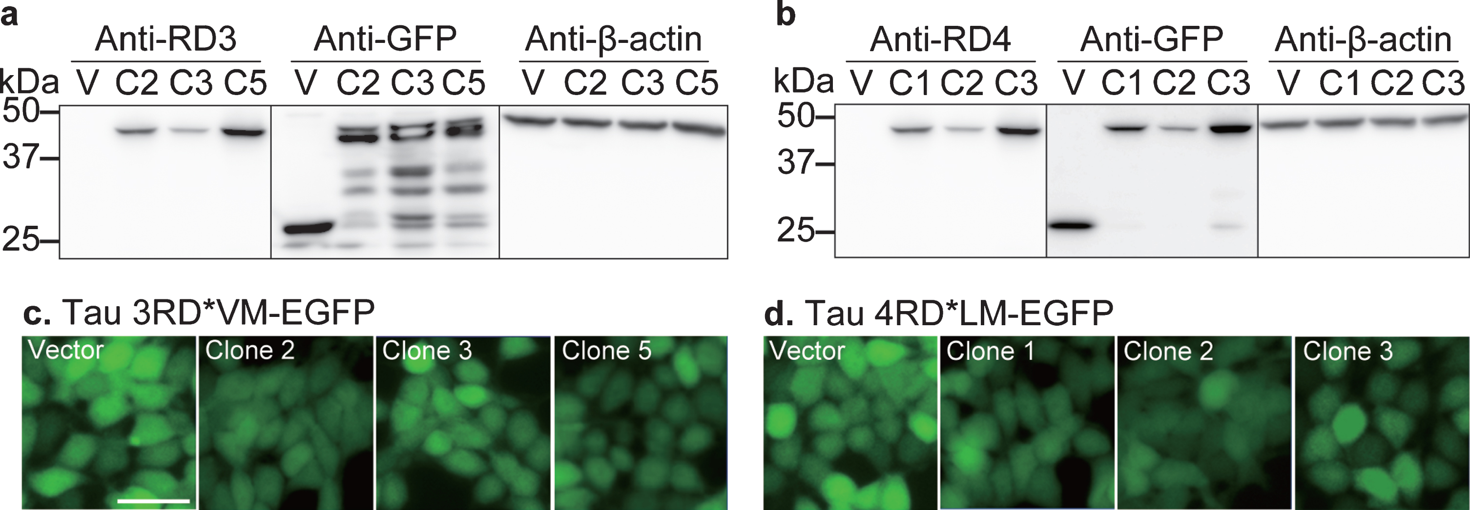 Development of a cellular model of tau propagation. Validation of (a) 3RD*VM-EGFP and (b) 4RD*LM-EGFP expression. Stable cells transfected with vector plasmid (V) and three stable selected clones (clone 2 (C2), clone 3 (C3), and clone 5 (C5) in 3RD*VM-EGFP and C1, C2, and C3 in 4RD*LM-EGFP) were probed with anti-tau three- or four-repeat isoforms (3RD or 4RD), anti-GFP, and anti-β-actin antibodies on separate membranes. A protein ladder (M) was used as a size reference. Representative images of HEK 293T cells expressing (c) 3RD*VM-EGFP and (d) 4RD*LM-EGFP. Scale bar = 20μm.