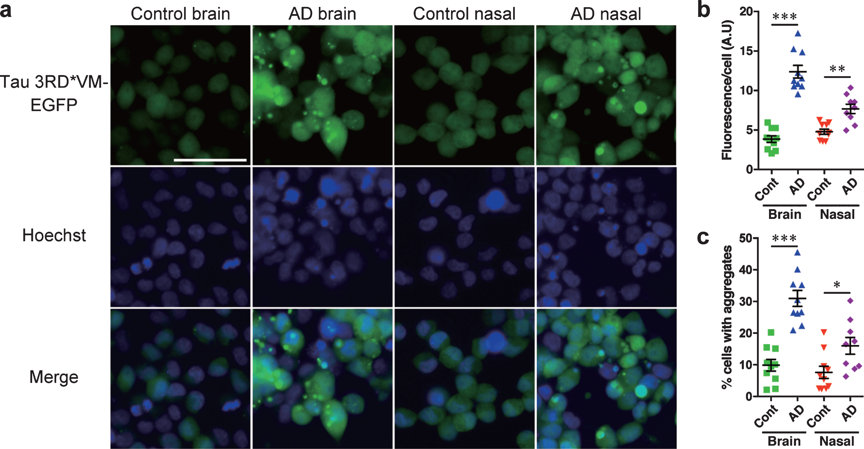HEK 293T cells stably expressing tau 3RD*VM-EGFP detect tau prions in the brain and nasal tissue homogenates from patients with AD. Brain and nasal tissue homogenates from control and AD patient samples were diluted in DPBS and incubated for 4 days with 3RD*VM-EGFP-expressing cells. a) Representative images of HEK 293T cells expressing 3RD*VM-EGFP seeded with the brain and nasal tissue homogenates from control individuals and patients with AD. Scale bar = 50μm. Quantification of tau aggregation by (b) fluorescence per cell. Data are presented as the mean±SEM measured from 10 samples per group, with the exception of AD nasal homogenates, for which nine samples were used, and (c) percentage of cells with aggregates. Data are presented as the mean±SEM measured from five images for each sample. *p < 0.05, **p < 0.001, ****p < 0.0001.