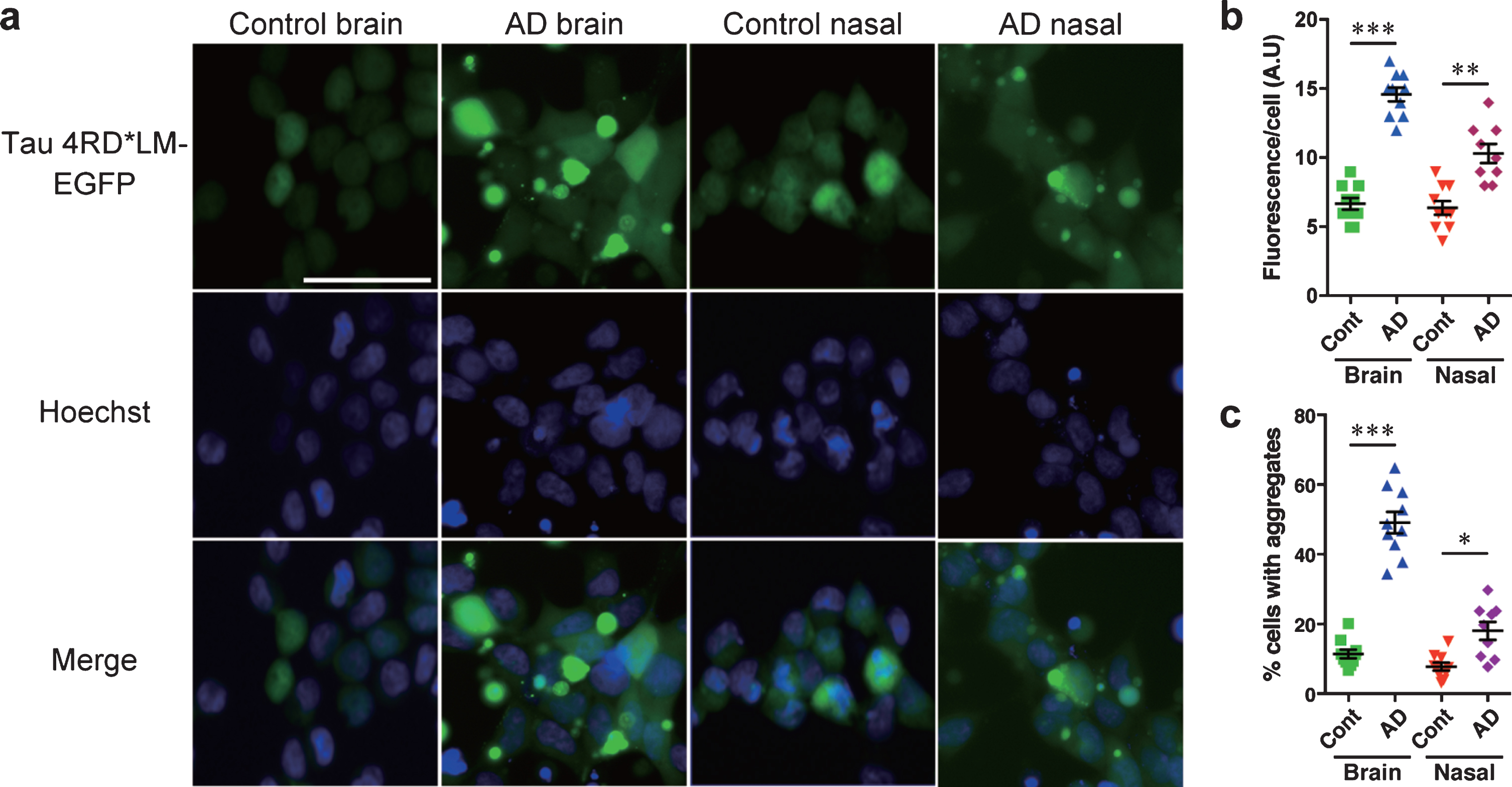 HEK 293T cells stably expressing tau 4RD*LM-EGFP detect tau prions in the brain and nasal tissue homogenates from patients with AD. The same methods were applied as those described for HEK293T cells stably expressing tau 3RD*VM-EGFP. a) Representative images of HEK 293T cells expressing 4RD*LM-EGFP seeded with the brain and nasal tissue homogenates from control individuals and patients with AD. Scale bar = 50μm. Quantification of tau aggregation by (b) fluorescence per cell. Data are presented as the mean±SEM measured from ten samples per group, with the exception of AD nasal homogenates, for which nine samples were used, and (c) percentage of cells with aggregates. Data are presented as the mean±SEM measured from five images for each sample. **p < 0.001, ****p < 0.0001.