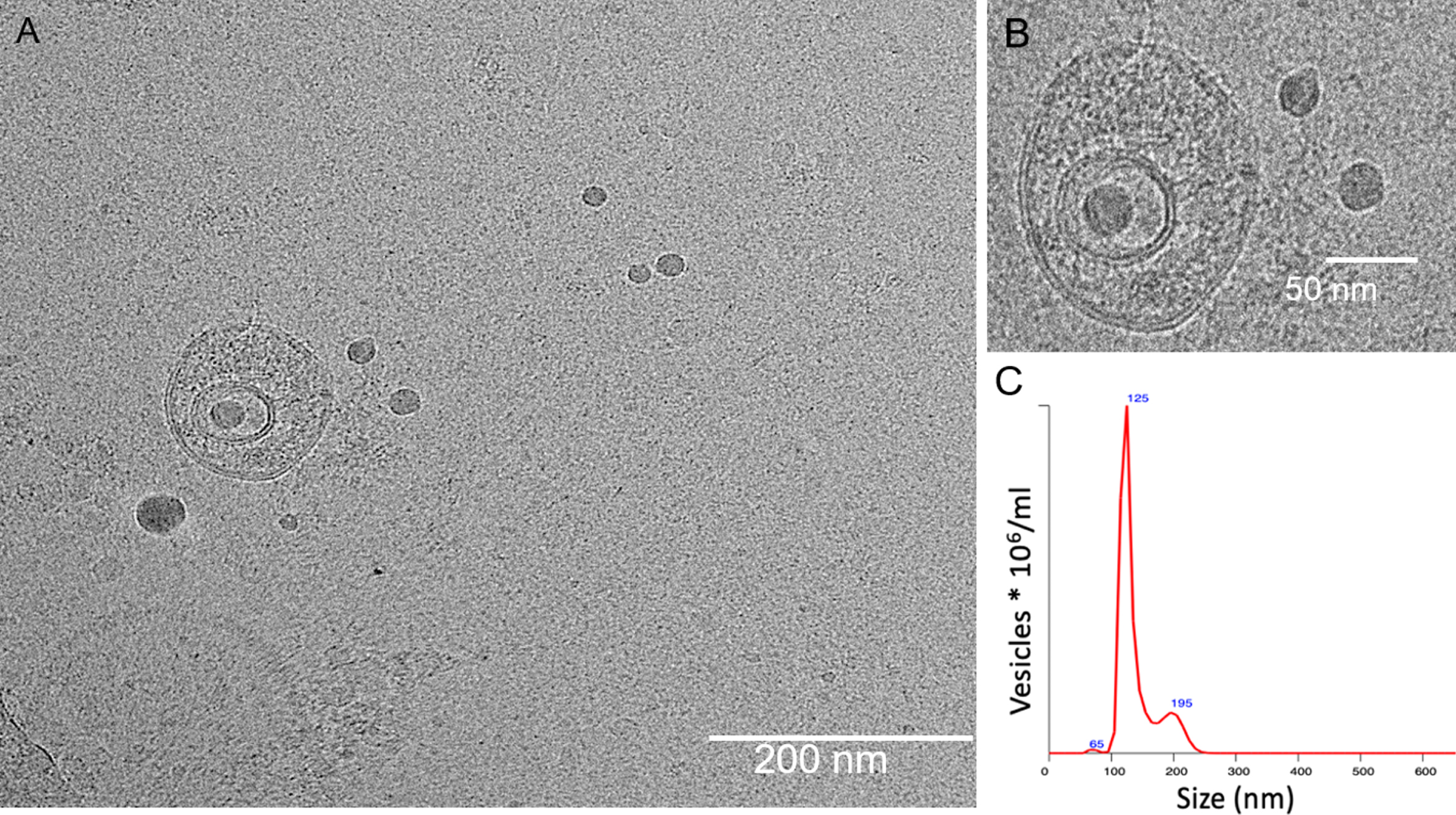 Cryo-transmission electron microscopy images of exosomes isolated from CSF sample. (A) Double-walled membrane vesicles identified from CSF sample. (B) High-resolution micrograph of the double-walled membrane vesicle. Scale bar (A) 200 nm and (B) 50 nm, respectively. (C) Size distribution and concentration of isolated exosomes evaluated by Nanosight.