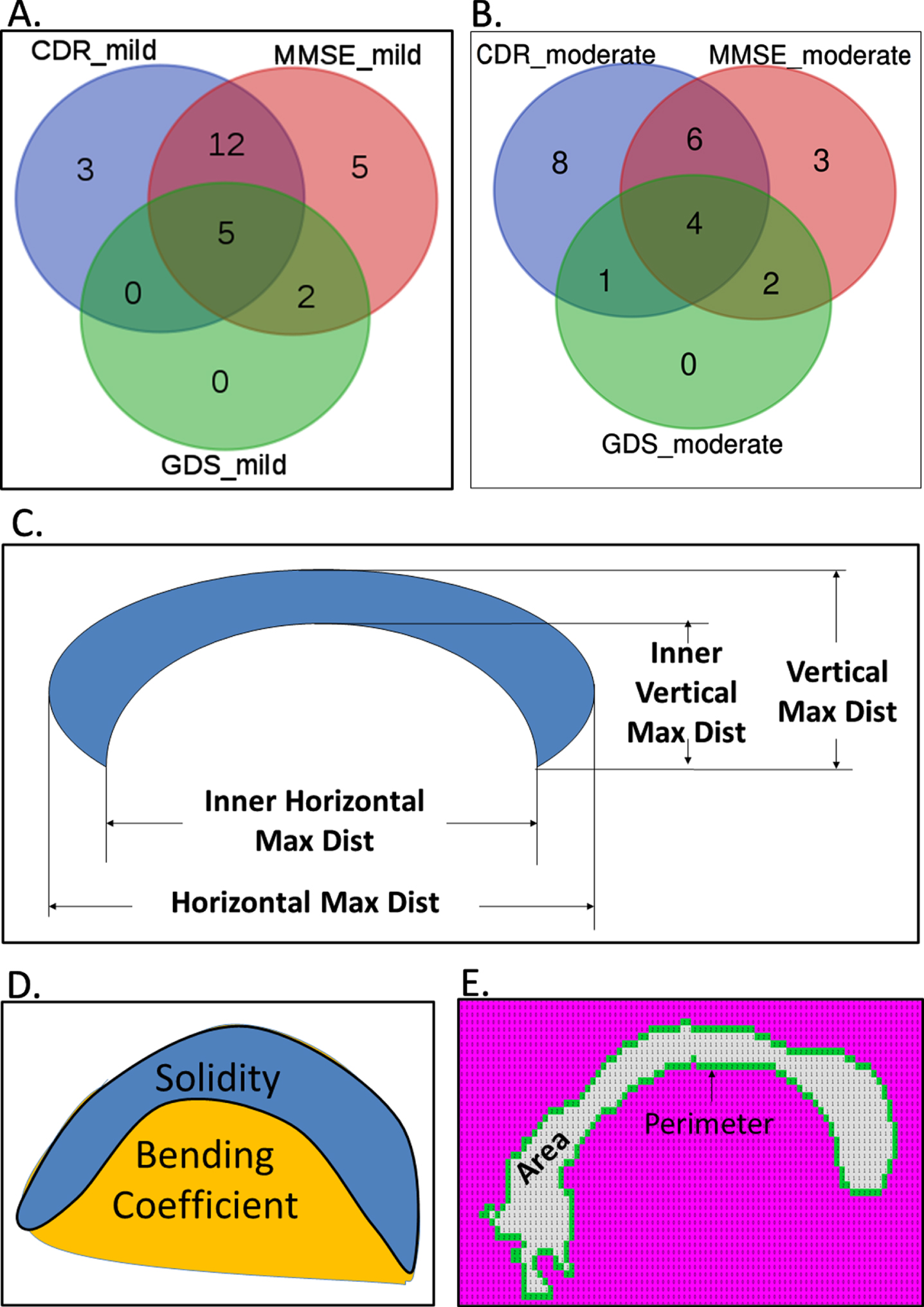 Structural and morphological features of corpus callosum (CC) that are significantly different between demented and healthy samples. Venn diagrams show the overlap of the CC features that were found to be significantly different (p < 0.01) between healthy and mild (A), healthy and moderate (B), respectively. Panel C, D, and E provide pictorial depiction of the measures of length and thickness, bending, and area of the CC regions, respectively.