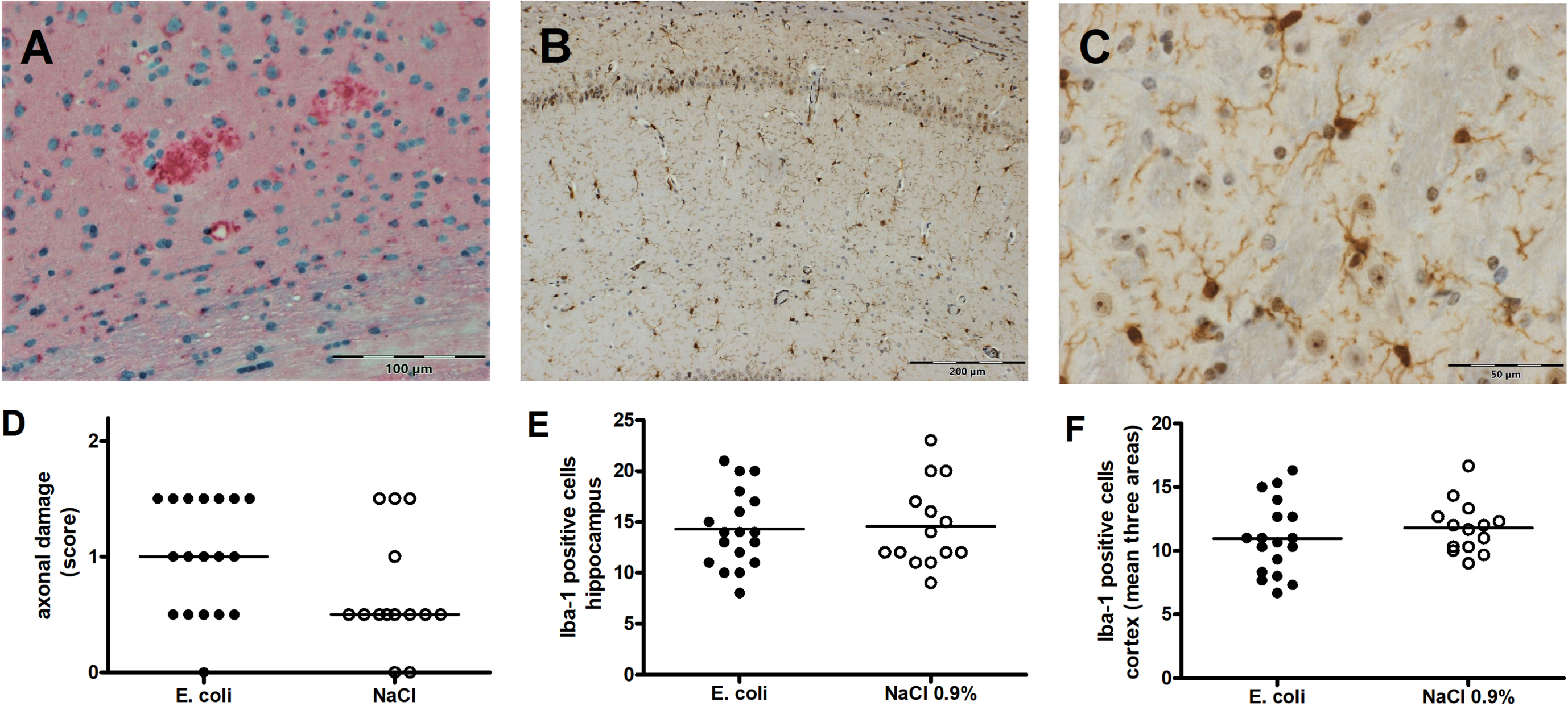 Axonal damage and microglia density in brains of Tg2576 +/- mice after intracerebral infection with E. coli. A) Representative amyloid-β protein precursor (AβPP) immunohistochemistry showing small lesions of axonal damage (pink) [35]. B) Representative Iba-1 staining showing microglial cells in the hippocampus (brown). C) Representative Iba-1 staining showing microglial cells in the neocortex (brown). D) Axonal damage quantified by a semiquantitative score (0 = no axonal damage, 3 = severe axonal damage) in brains of infected and non-infected Tg2576 +/- (medians and single values; p = 0.074, Mann-Whitney U-test). E) Numbers of microglial cells (means and single values) in the hippocampus of infected and non-infected Tg2576 +/- mice (p = 0.84, Student’s t-test). F) Numbers of microglial cells (means and single values of means of 3 areas) in the neocortex of infected and non-infected Tg2576 +/- mice (p = 0.37, Student's t-test).