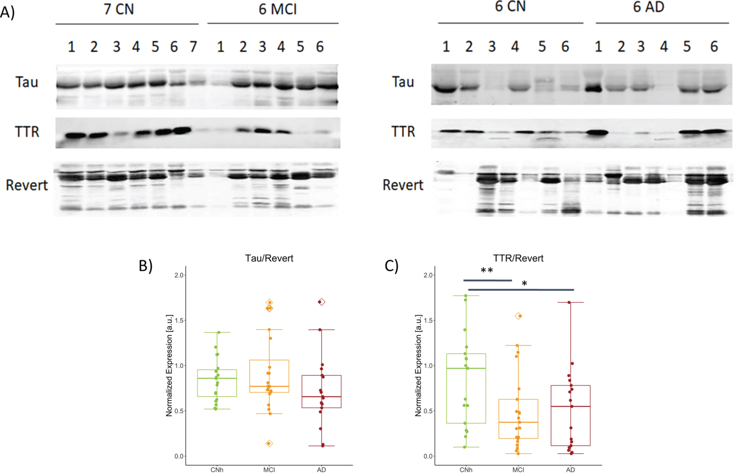 Abundance of TTR and S100A8 among the stages of AD. A) Representative images from western blot procedure to capture TTR and Tau bands, 17 kDa and 79 kDa respectively. No. of samples analyzed: CNh = 19, MCI = 21, AD = 17. Box plots with jitter across CNh, MCI, and AD groups show B) Tau expression normalized to loading control, Revert, CNh versus MCI t39 = 0.291, p = 0.437; CNh versus AD t35 = 0.278 p = 0.906; MCI versus AD t37 = 0.185 p = 0.241, C) normalized TTR, CNh versus MCI t39 = 0.007 p = 0.437; CNh versus AD t35 = 0.018 p = 0.019; MCI versus AD t37 = 0.845 p = 0.241. The whiskers on the boxplot represents the range of population and the horizontal line the median, *p < 0.05 and **p < 0.01.