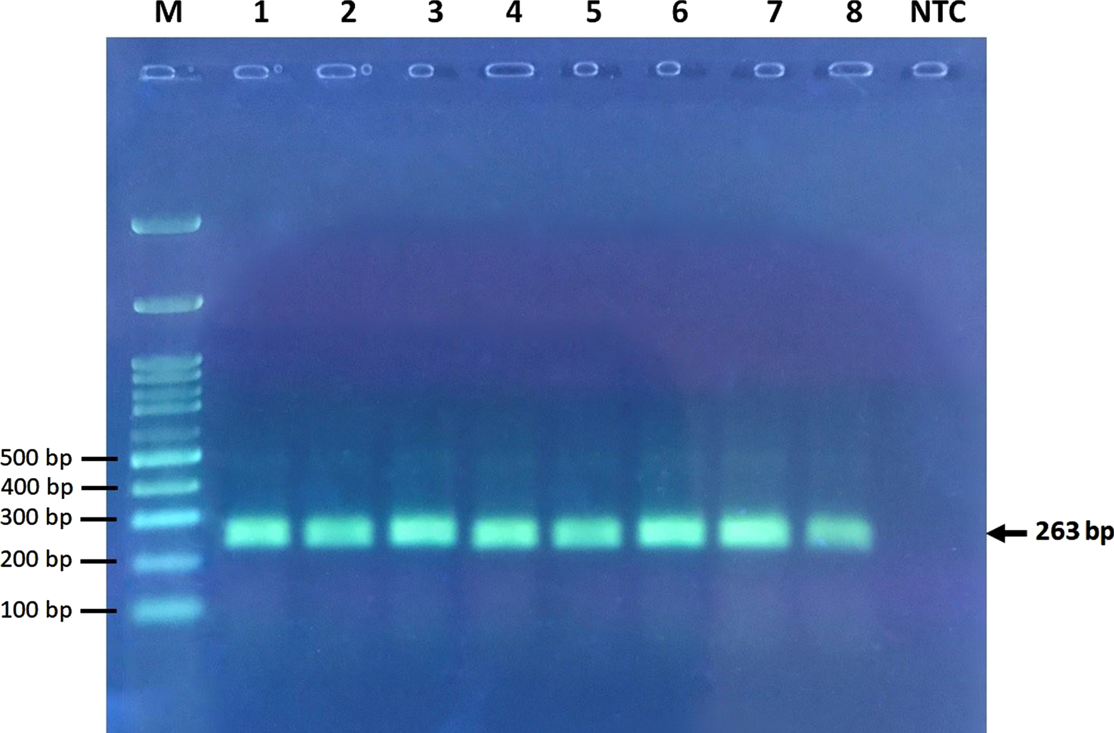 Electrophoresis of undigested PCR products. M, marker ladder; NTC, no template control ladder.