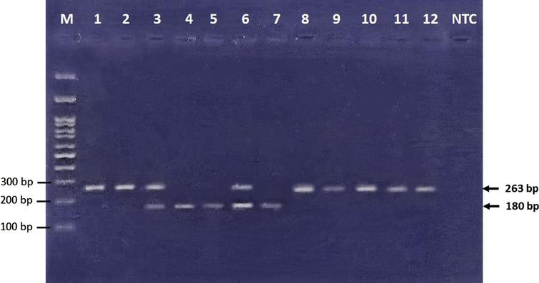 Electrophoresis of restriction products. 83 bp band cannot be visualized in this figure due to usage of 3% agarose gel, which can show DNA fragment size of larger than 100 bp. GG (wild type homozygote genotype) ⟶ Bands No. 1, 2, 8–12 (263 bp). GA (heterozygote genotype) ⟶ Bands No. 3, 6 (263, 180, and 83 bp). AA (mutant homozygote genotype) ⟶ Bands No. 4, 5, 7 (180 and 83 bp).