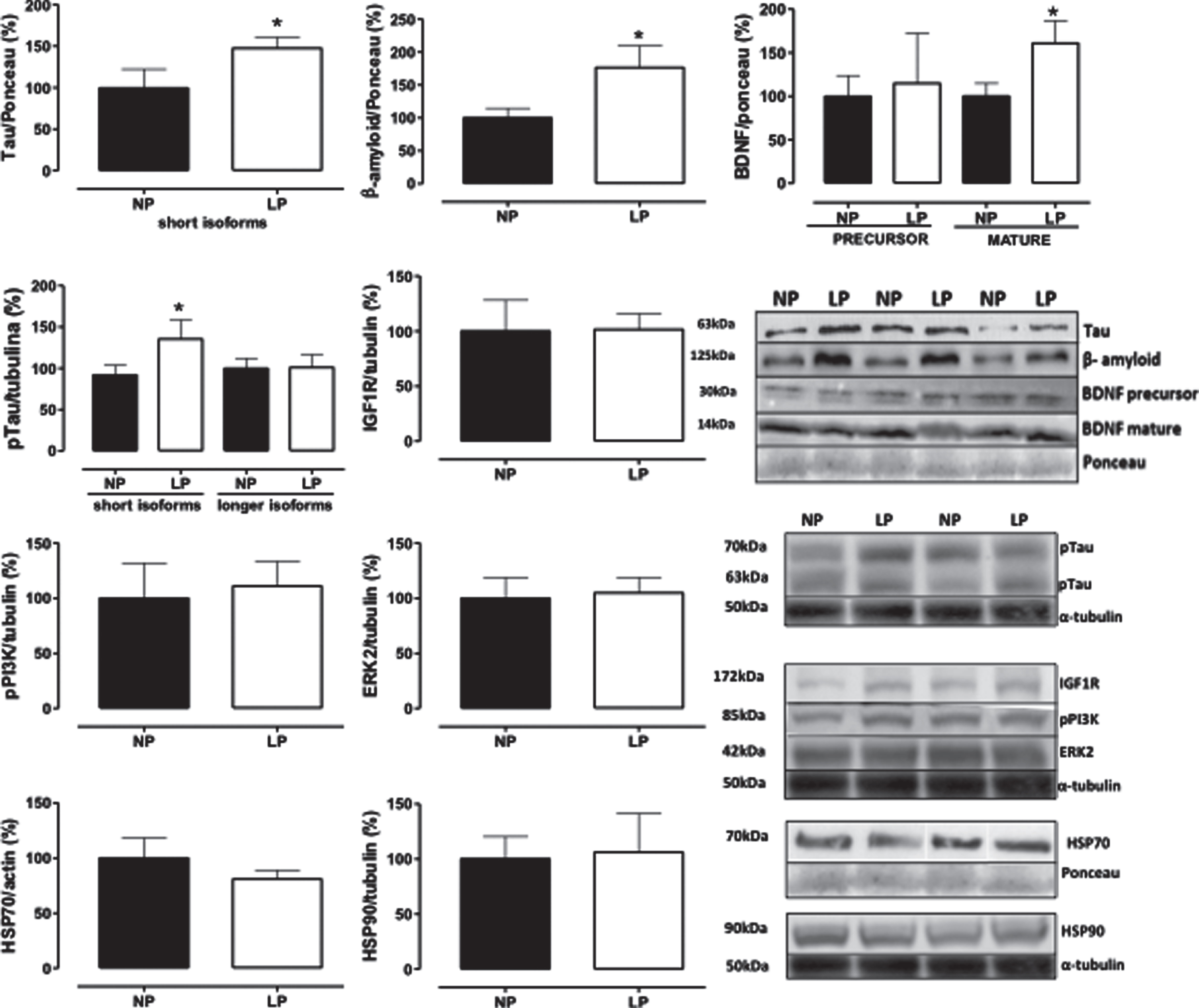 Effect of maternal protein restriction on amyloid-β, tau, BDNF, HSP70, HSP90, IGF1R, pPI3K, and ERK2 proteins, measured using immunoblotting analysis, in the isolated whole hippocampus of 88-week-old LP (n = 4) as compared to age-matched NP (n = 4) rats. Results are expressed as means±SEM; only one offspring of each litter was used for immunoblotting experiments. A comparison involving only two samples of independent observations was performed using a Student’s t-test. The level of significance was set at *p < 0.05.