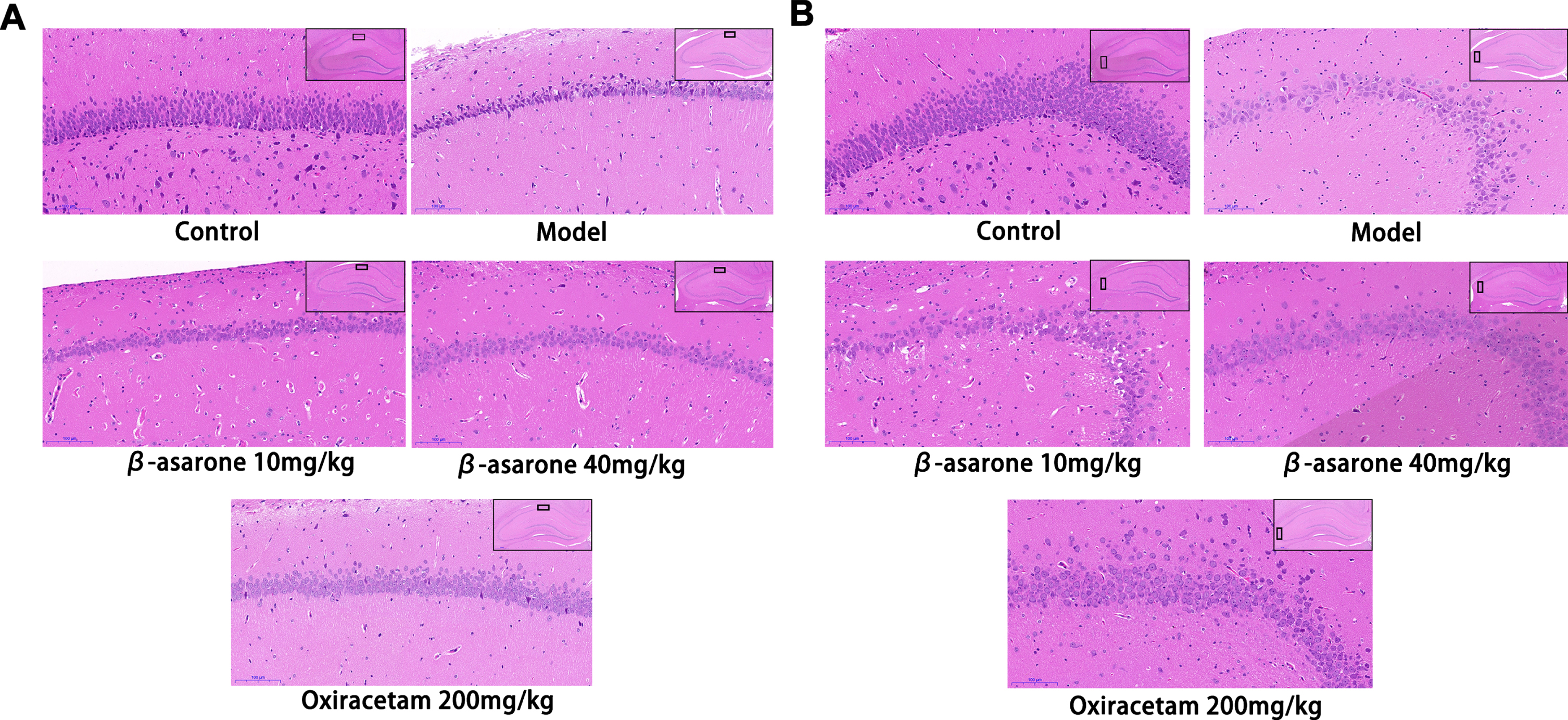 HE staining of pathological sections of rats’ hippocampus. The expression of neurons in CA1 (A) and CA3 (B) areas in different groups. In the control group, neurons in CA1 and CA3 areas were neatly arranged, dense and evenly distributed, with clear cell outlines and obvious rounded nuclei. The number of neurons in the CA1 and CA3 regions of the model group was significantly reduced, with abnormal morphology and disordered arrangement. The cells in the CA1 and CA3 areas of the β-asarone group and the positive drug group were arranged neatly and evenly, the cell outline was clearer, and the shape returned to normal.