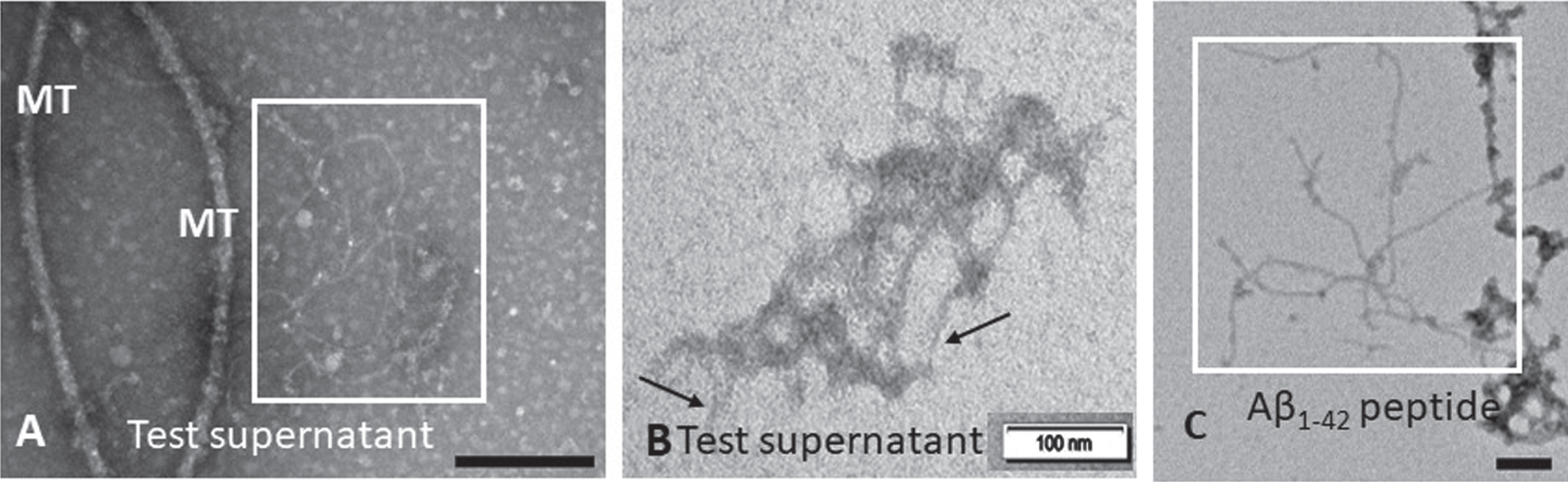 TEM detection of insoluble Aβ fibrils in Pg381 treated supernatant. Examination for insoluble Aβ in the supernatant from SH-SY5Y treated with P. gingivalis crude conditioned medium (A box and B arrows) demonstrated Aβ fibrils. The boxed area in panel C shows a positive control for Aβ fibrils from a commercial peptide Aβ42 under the TEM. MT = microtubule fragments. Micron bars represent 100 nm size.