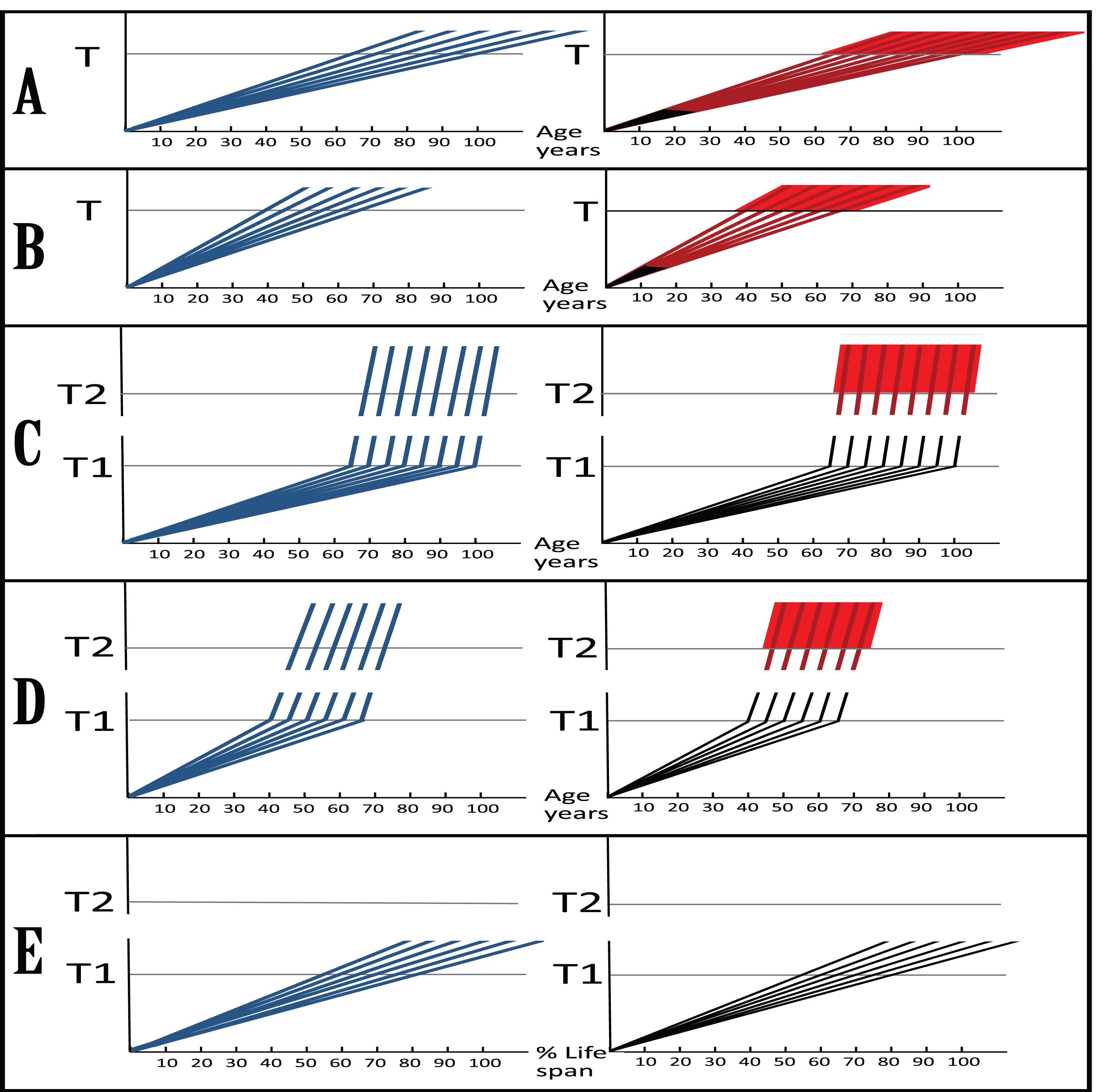 Dynamics of Aβ accumulation and the disease in AD-affected patients: Two paradigms. Images on the left: Dynamics of Aβ accumulation (extracellular in A and B, intraneuronal in C-E); Images on the right: Dynamics of neurodegeneration. Blue lines: Levels of Aβ; Red lines: Extent of neurodegeneration; Black lines: Indicator lines, no noticeable neurodegeneration; Red blocks: Symptomatic manifestation of AD. T: Threshold of extracellular Aβ levels and the corresponding extent of cell damage triggering AD symptoms; T1: Threshold of AβPP-derived iAβ levels required for the activation of the AβPP-independent iAβ production pathway (genetic aspects and epigenetic factors influence the timing of the T and T1 crossings, hence the fanning lines); T2: Threshold of iAβ levels and the corresponding extent of neuronal damage triggering AD symptoms (T, T1, and T2 are patient-specific). A (SAD ), B (FAD): Dynamics of AD in the old paradigm. Levels of extracellular Aβ increase and so does the extent of neurodegeneration; when the T is reached, AD symptoms manifest. C (SAD), D (FAD): Dynamics of AD in the new paradigm. As AβPP-derived iAβ cross the T1, AβPP-independent production of iAβ is activated and its levels rapidly increase. After a lag period during which iAβ further accumulates, neurodegeneration commences; when the T2 is reached, AD symptoms manifest. Red and blue lines over the T1 threshold are shown arbitrarily as parallel (i.e., identical rates of the accumulation of iAβ produced independently of AβPP and of the corresponding extent of cellular damage) and as of uniform heights over the T2 threshold (i.e., equal extents of damage); in reality, both the rates and the extents and, accordingly, lines’ angles and their heights over the T2 are likely different and define the duration of the disease in individual AD patients. E: Presumed dynamics of iAβ accumulation in subjects with an inoperative AD Engine. AβPP-derived iAβ levels cross the T1 threshold but the AβPP-independent iAβ production pathway is not activated. Neither neurodegeneration-triggering iAβ levels nor the T2 threshold are reached; there is no noticeable neurodegeneration, no AD symptoms manifest, no disease occurs.
