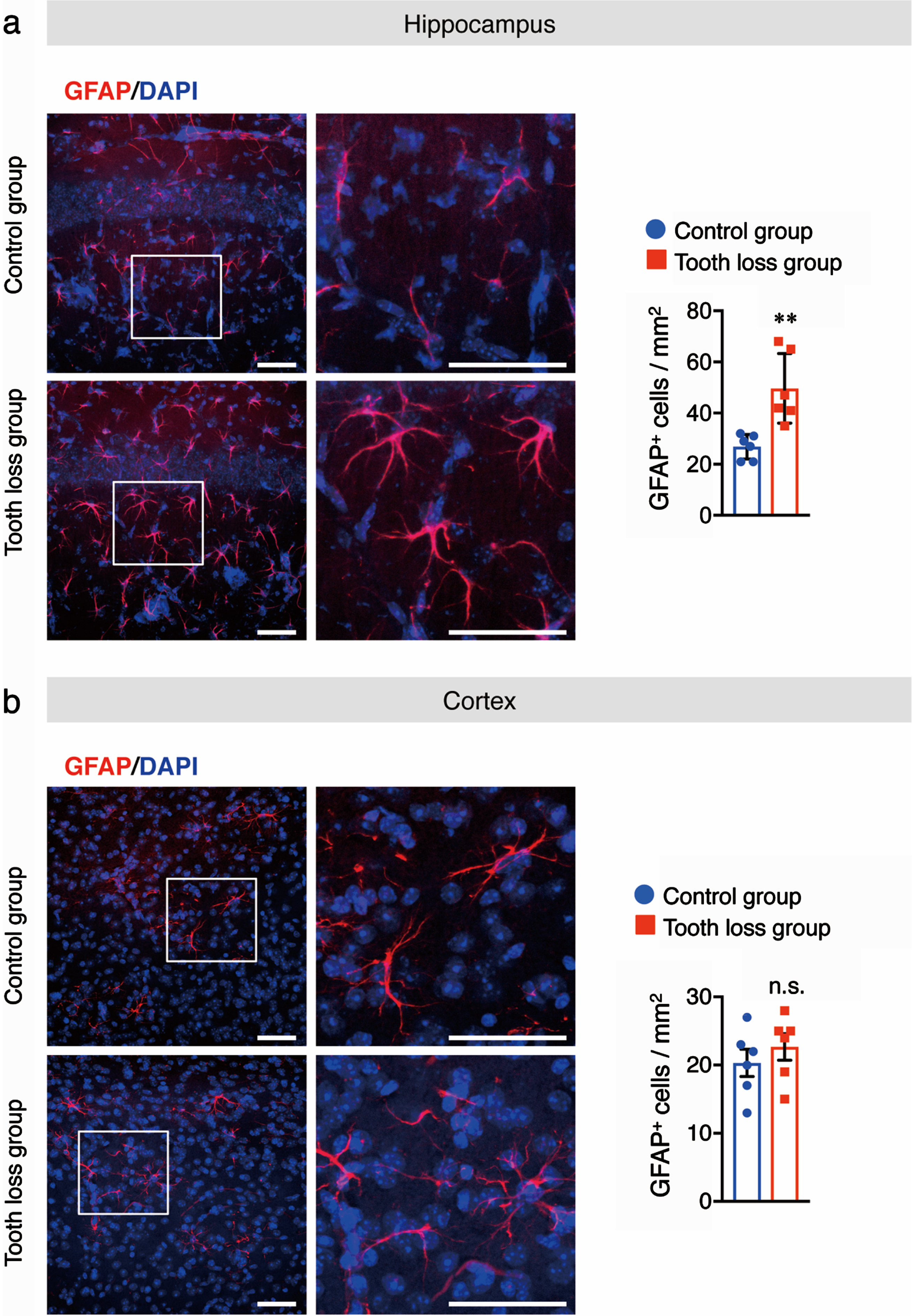 Tooth loss enhances astrocyte activation in the hippocampus. Sagittal brain sections of mice were immunostained with the anti-GFAP antibody (red) and cell nuclei were stained with DAPI (blue). Representative images of GFAP+ cells in the hippocampus (a) and cortex (b) are shown. Numbers of GFAP+ cells in the hippocampus (a, right panel) and cortex (b, right panel) are presented. Boxed regions in the left panel images are magnified in the right panels. Data are represented as the mean±SD. n = 6 per group. n.s., no significant difference; **p < 0.01 versus control group, as determined using Student’s t-test. Scale bars: 100μm.