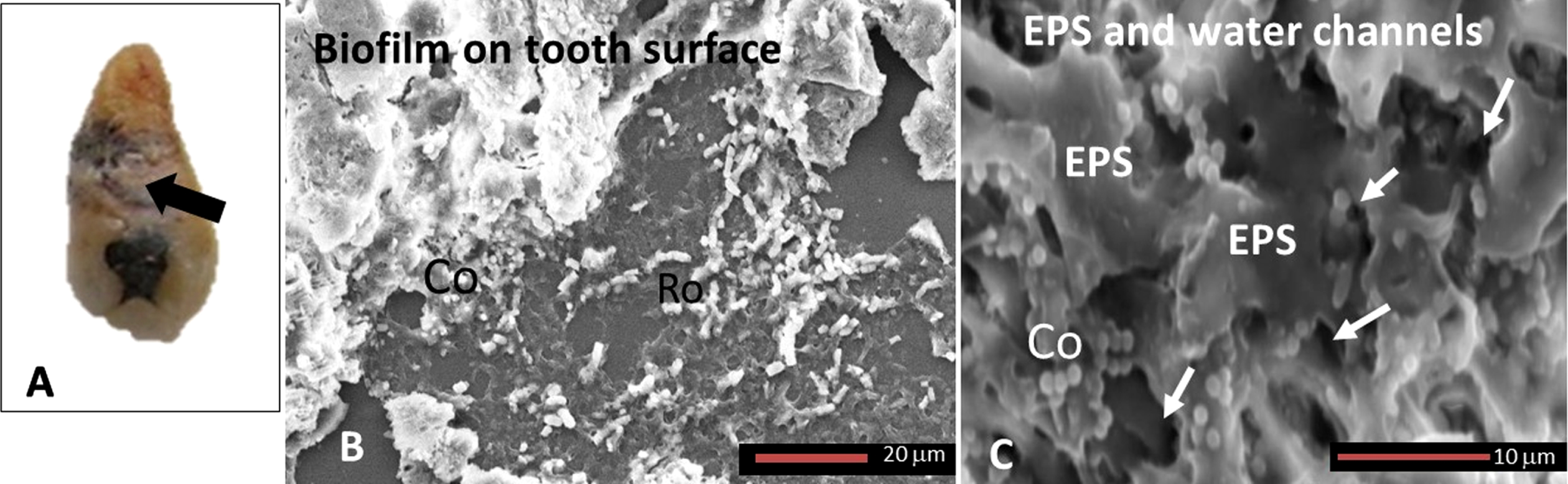 Calculus on a tooth’s external surface for biofilm characteristics. A) Macroscopic image of an extracted tooth (black arrow) to show calculus and plaque deposits on the external root surface. B) SEM images of the calculus deposits from the external tooth root surface shown in A revealed a polymicrobial biofilm composed mainly of cocci (Co) and rod (Ro) shaped bacteria. C) The biofilm shows extracellular polymeric substance (EPS) with smooth appearance on which cocci (Co) shaped bacteria are clearly visible with the occasional rod (Ro) shaped bacterium. Smooth EPS demonstrated an abundance of water channels with variable openings as indicated by white arrows. Magnification as per micron bar.