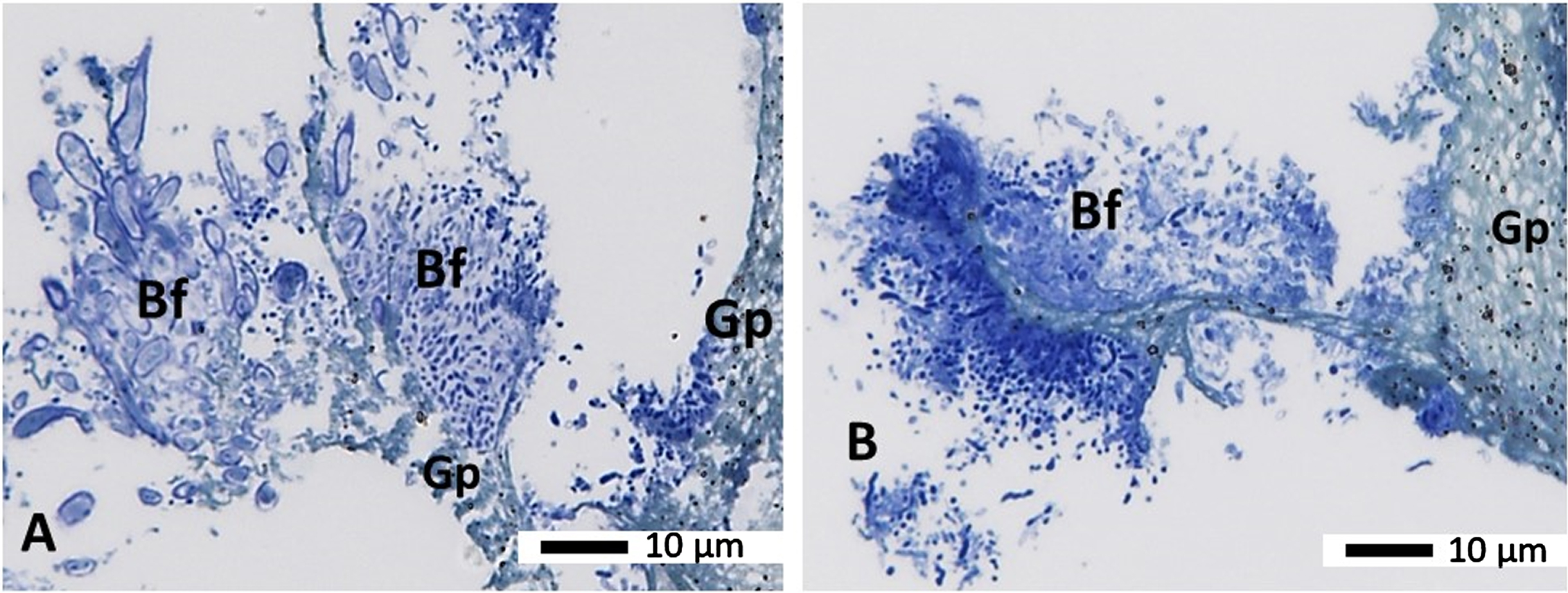 Semithin sections from a gutta percha from a failed root treatment (secondary endodontic infection Group B) embedded in Araldite resin. Panels A and B show semi-thin sections stained with the morphology stain Toluidine blue showing the biofilm (Bf) on the gutta percha (Gp). A variety of microbes (stained blue) can be seen growing on and slightly away from the gutta percha (Gp), which has a green/blue/greyish shade with black dots in it. Magnification as per micron bar.