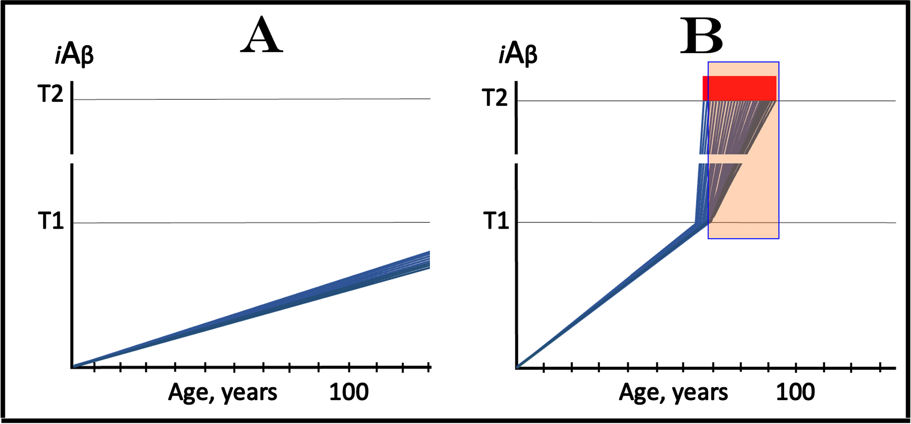 T1 threshold arbitrates between health and disease: AD is defined by the dynamics of iAβ accumulation. Blue lines: Levels of iAβ in individual AD-affected neurons. Threshold T1: The level of AβPP-derived iAβ that triggers cellular processes resulting in the activation of the AβPP-independent generation of iAβ. Threshold T2: The level of iAβ and the consequent degree of neurodegeneration causing cellular commitment to apoptosis and acute AD symptoms. Red blocks: Apoptotic zone. Panel A: Levels of iAβ do not reach the T1 threshold within the lifetime of an individual; no AD occurs. Panel B: the neuronal crossing of the T1 threshold occurs within a narrow time window. Subsequent to the crossing of the T1 threshold, the AβPP-independent iAβ generation pathway is activated, the rate of iAβ accumulation is sharply elevated and its levels advance toward and cross the T2 threshold in a broad stochastic distribution; the temporal duration of this distribution determines the duration of the disease. Orange field: A zone where drugs targeting the influx of AβPP-derived iAβ would have no effect on the disease. For details see main text.
