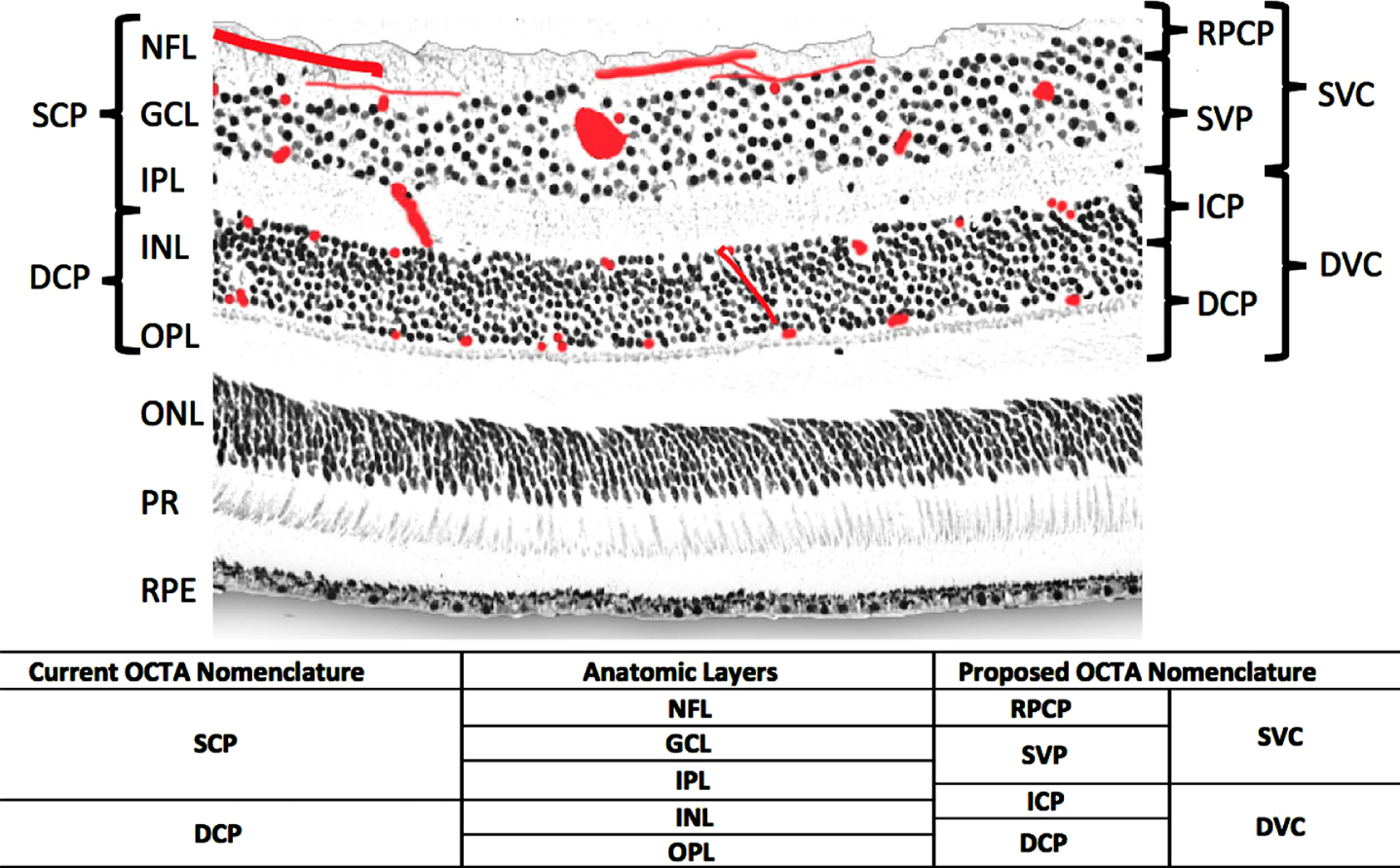 Anatomic layers, previous and new optical coherence tomography angiography (OCTA) segmentation names [15]. PR, photoreceptor layer.