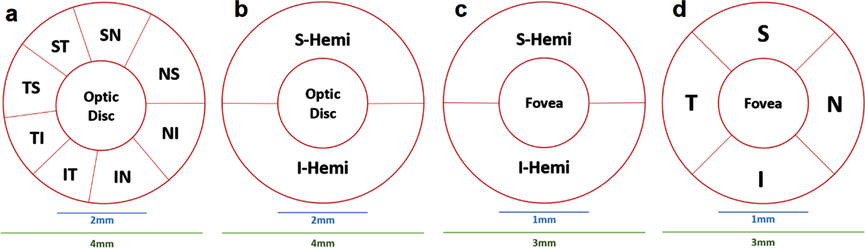 HD Angio Disc mode (optic disc) Report Layout Legend: a) Garway-Heath (GH) map [31]; b) Hemisphere Maps; 2) Angio Retina mode (macular) Report Layout Legend: c, d) Hemisphere and Quadrant Maps [32].