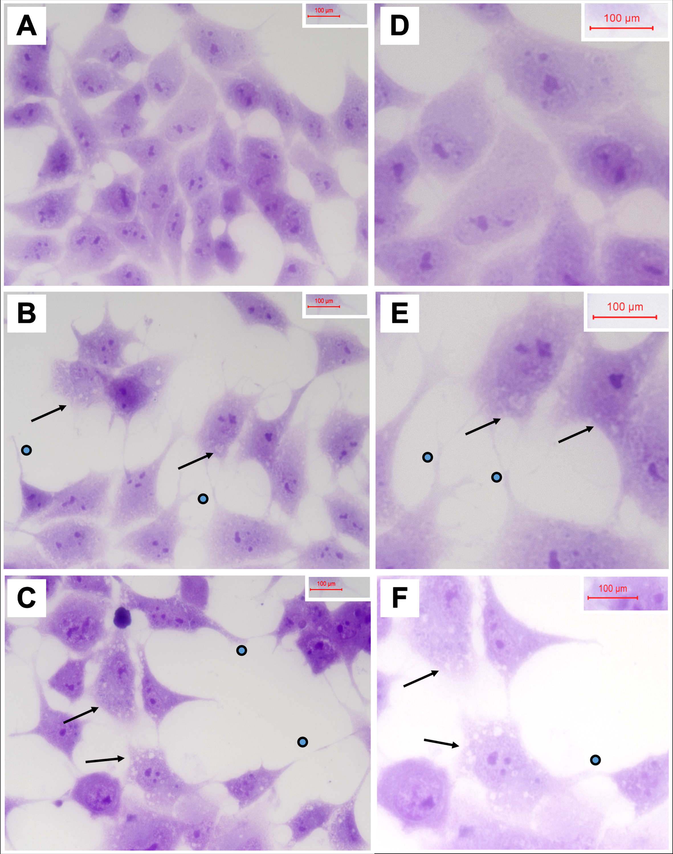 Degenerative cytomorphological effects of 2,4-D and 2,4,5-T. PNET2 cells seeded into 8-well chamber slides were treated with A, D) vehicle, B, E) 250μg/ml 2,4-D, or C, F) 250μg/ml 2,4,5-T for 48 h. Cells were stained with Hematoxylin after 10% formalin fixation. Note lower cell densities, cytoplasmic vacuolations (arrows), and irregular cell process extensions (dots) in the 2,4-D and 2,4,5-T treated cultures. Photographs were taken at A-C) 400x and D-F) 600x. Final image magnification scale bars are displayed.