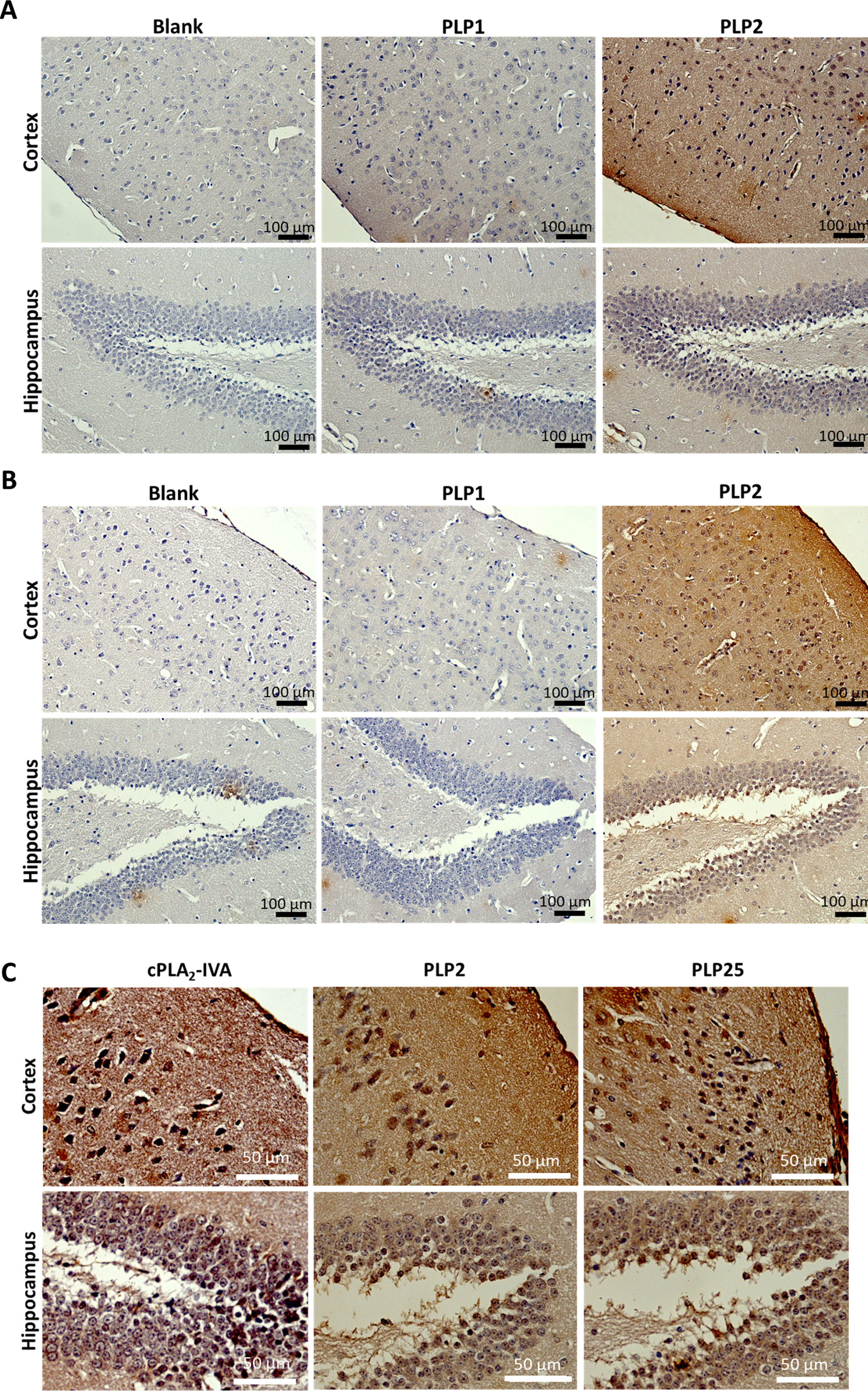 Detection of PLP1, PLP2, and PLP25 binding to NMRI (A) or APP/PS1 (B) brain slices. Peptides are in brown, highlighted by DAB. C) Comparison of the cPLA2-IVA staining with those obtained for PLP2 and PLP25 peptides in the cortex and the hippocampus of APP/PS1 mice.