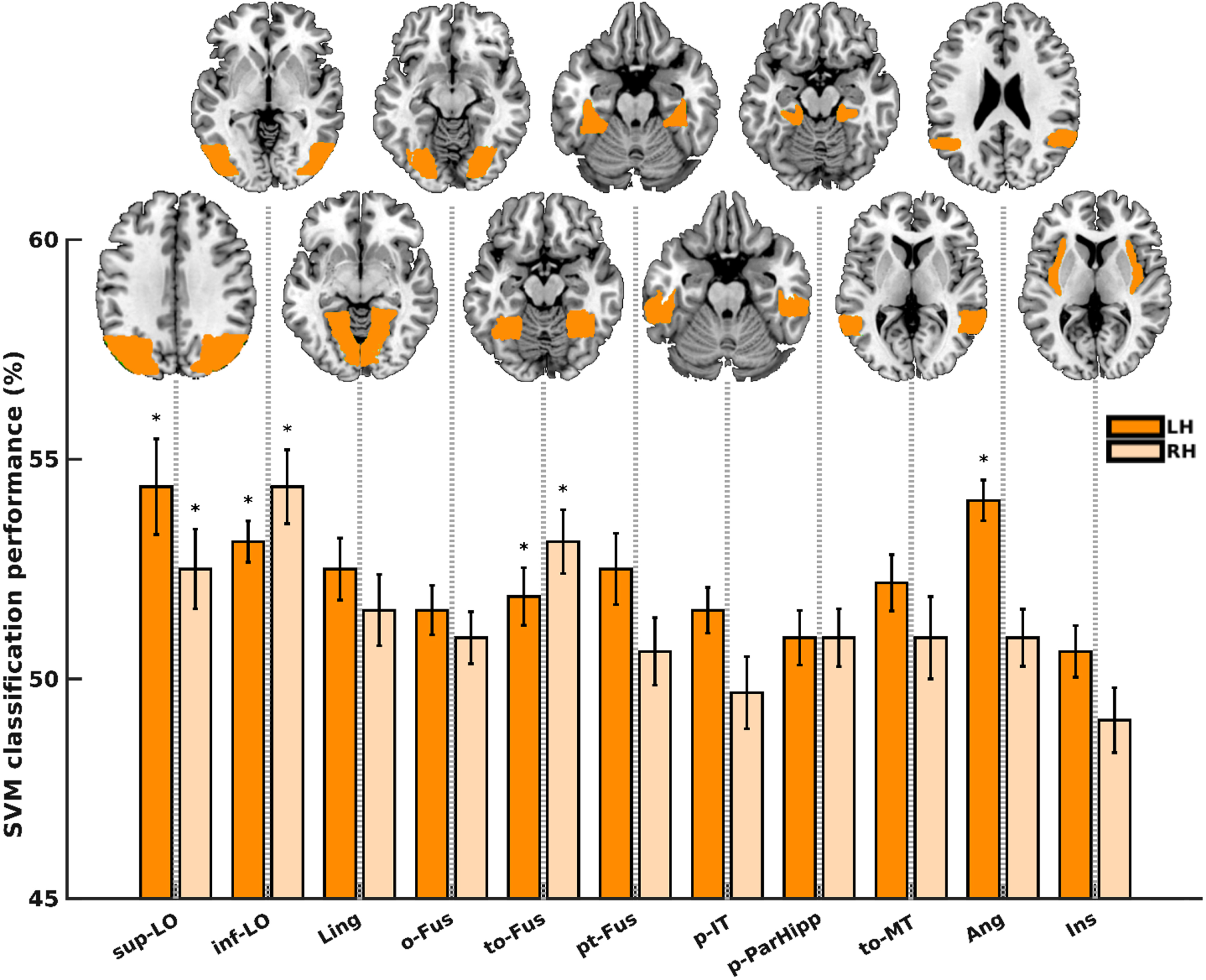 Animacy decoding in the MCI group. Dark and light orange bars represent the left and right hemispheres, respectively. Bars marked with asterisk (*) are regions remained significant following FDR correction. sup-LO, lateral occipital cortex, superior division; inf-LO, lateral occipital cortex, inferior division; Ling, lingual gyrus; o-Fus, occipital fusiform gyrus; to-Fus, temporal occipital fusiform cortex; pt-Fus, temporal fusiform cortex, posterior division; p-IT, inferior temporal gyrus, posterior division; p-ParaHipp, parahippocampal gyrus, posterior division; to-MT, middle temporal gyrus, temporooccipital part; Ang, angular gyrus; Ins, insular cortex.