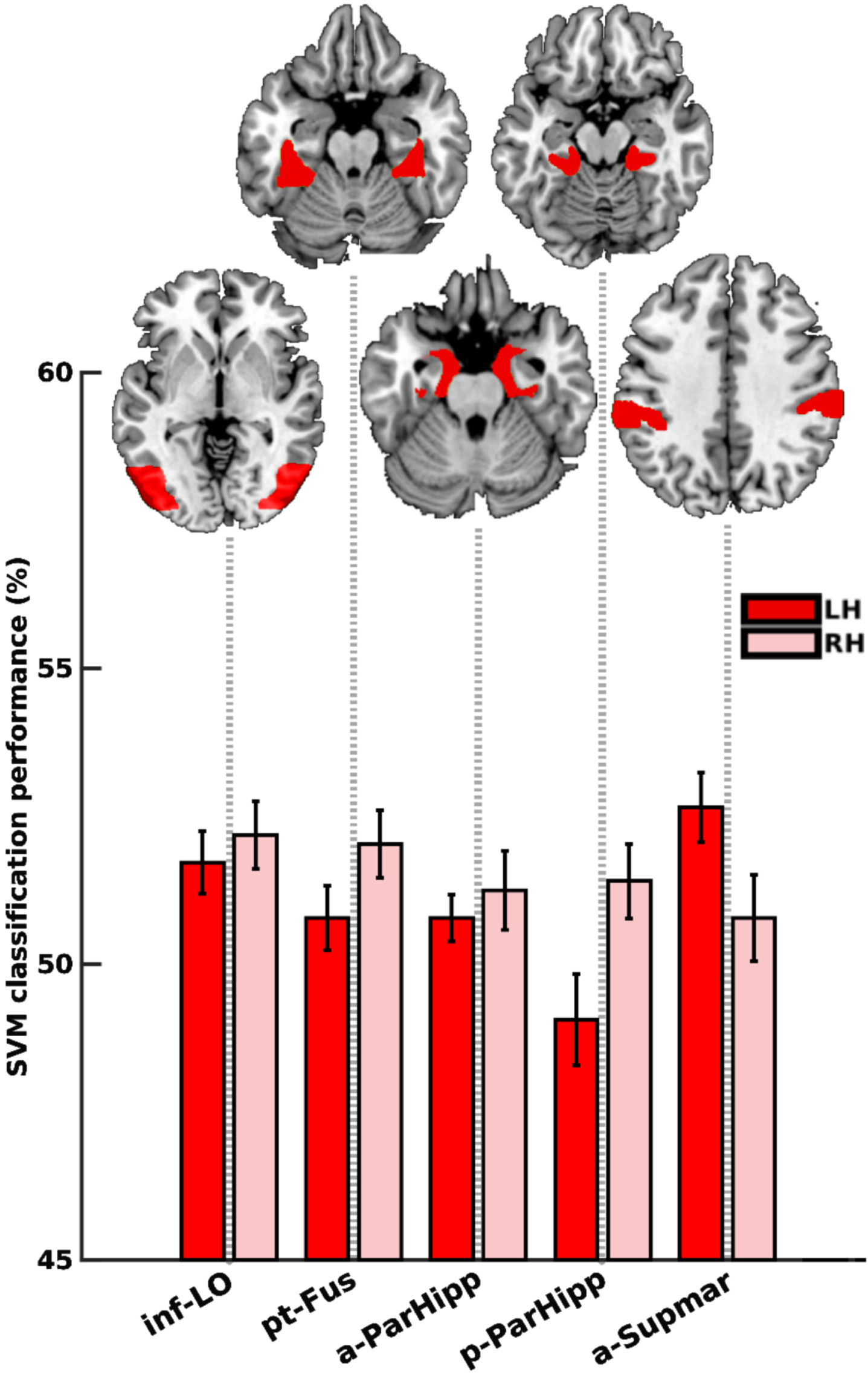 Animacy decoding in the mild AD group. Dark and light red bars represent the left and right hemispheres, respectively. No region remained significant following FDR correction. inf-LO, lateral occipital cortex, inferior division; pt-Fus, temporal fusiform cortex, posterior division; a-ParaHipp, parahippocampal gyrus, anterior division; p-ParaHipp, parahippocampal gyrus, posterior division; a-Supmar, supramarginal gyrus, anterior division.