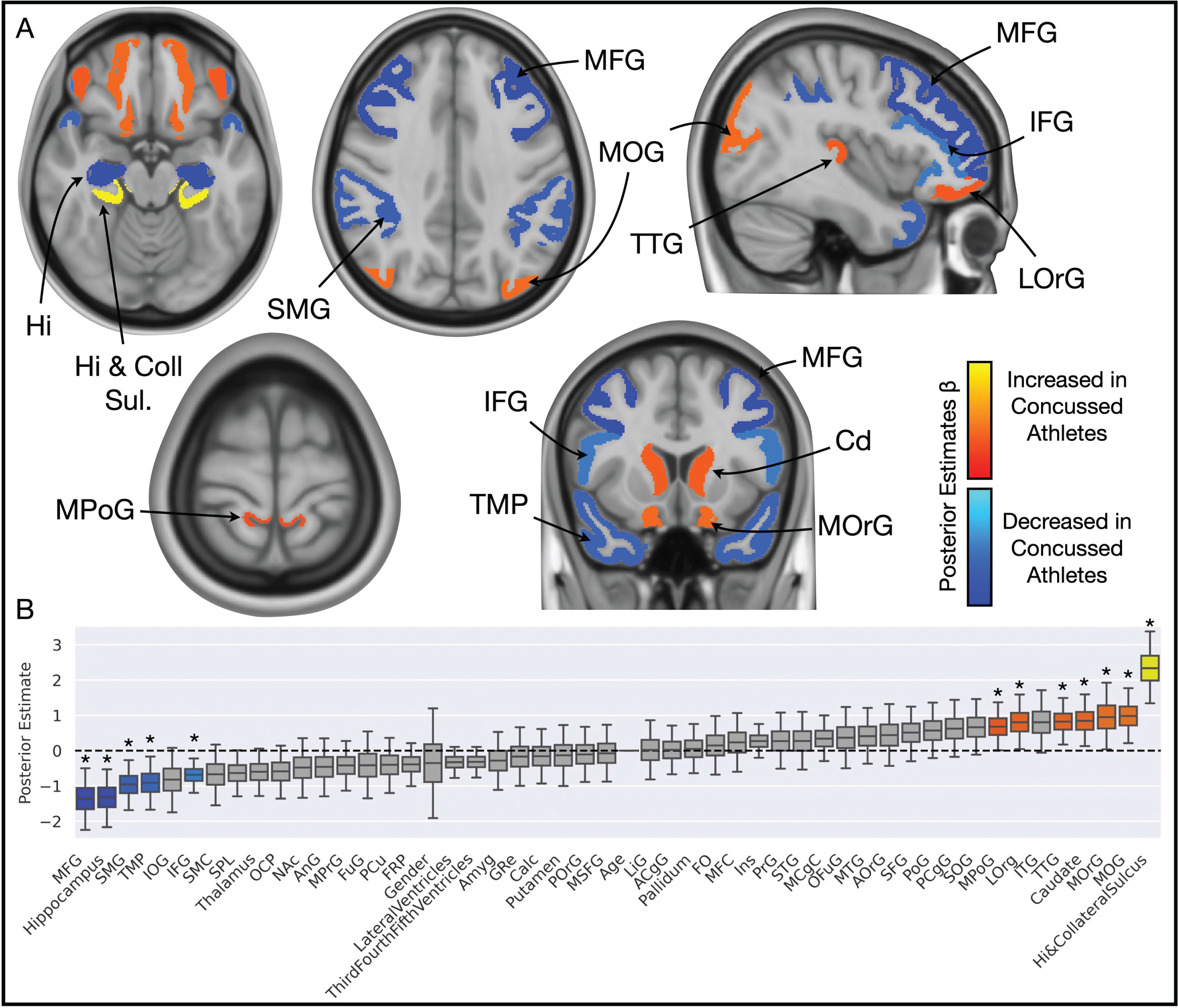 Grey matter volumetric differences across the cohort. A) Brain slices and B) boxplot illustrate color-coded posterior estimates of betas from Bayesian logit, wherein red-orange-yellow regions are those found to increase in volume in the athlete group, compared to the controls; reciprocally, blue and light blue regions are those found to decrease in volume in the athlete group, compared to the controls. Only significant regions are shown on the brain images, and the color is also aligned to the boxplot. Amyg, amygdala; ACgG, anterior cingulate gyrus; AOrG, anterior orbital gyrus; AnG, angular gyrus; Calc, calcarine cortex; FO, frontal operculum; FRP, frontal pole; FuG, occipital fusiform gyrus; GRe, gyrus rectus; Hi, hippocampal [sulcus]; Ins, insula; IFG, inferior frontal gyrus; IOG, inferior occipital gyrus; ITG, inferior temporal gyrus; LiG, lingual gyrus; LOrg, lateral orbital gyrus; MCgG, middle cingulate gyrus; MFC, medial frontal cortex; MFG, middle frontal gyrus; MOG, middle occipital gyrus; MOrG, medial orbital gyrus; MPoG, postcentral gyrus medial segment; MPrG, precentral gyrus medial segment; MSFG, superior frontal gyrus medial segment; MTG, middle temporal gyrus; NAc, nucleus accumbens; OCP, occipital pole; OFuG, occipital fusiform gyrus; PCgG, posterior cingulate gyrus; PCu, precuneus; PoG, postcentral gyrus; POrG, posterior orbital gyrus; PrG, precentral gyrus; SFG, superior frontal gyrus; SMC, supplementary motor cortex; SMG, supramarginal gyrus; SOG, superior occipital gyrus; SPL, superior parietal lobule; STG, superior temporal gyrus; TMP, temporal pole; TTG, transverse temporal gyrus.