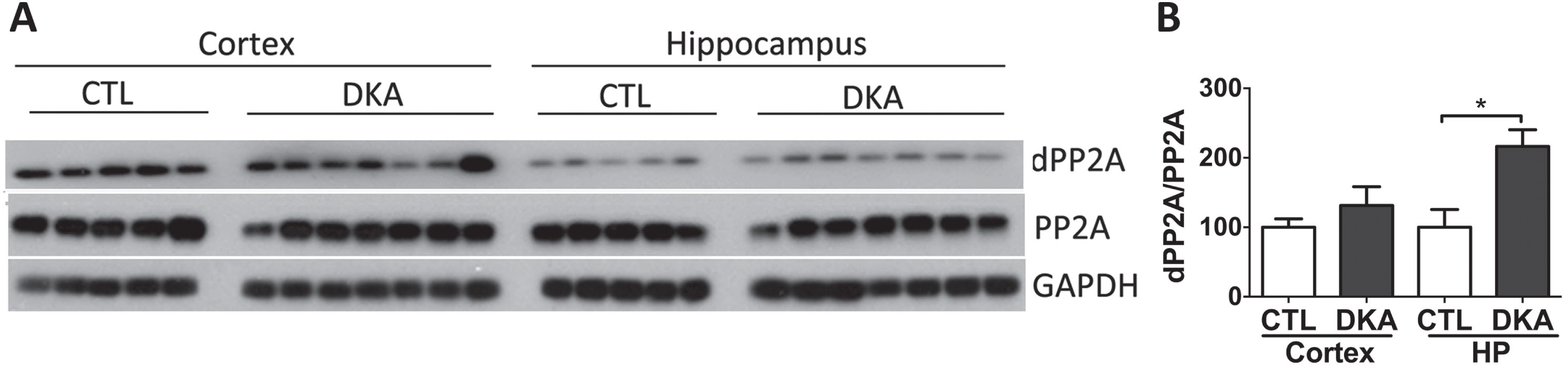 Western blots of PP2A in the brains of rats with DKA. Brain homogenates derived from the rat hippocampal and cortical homogenates were subjected to western blots developed with antibodies against the catalytic subunit of PP2A or demethylated PP2A (dPP2A) (A). The blots were then quantified by densitometry, and the relative levels of dPP2A/PP2A are shown in (B) (mean±SEM, n = 5−7/group).